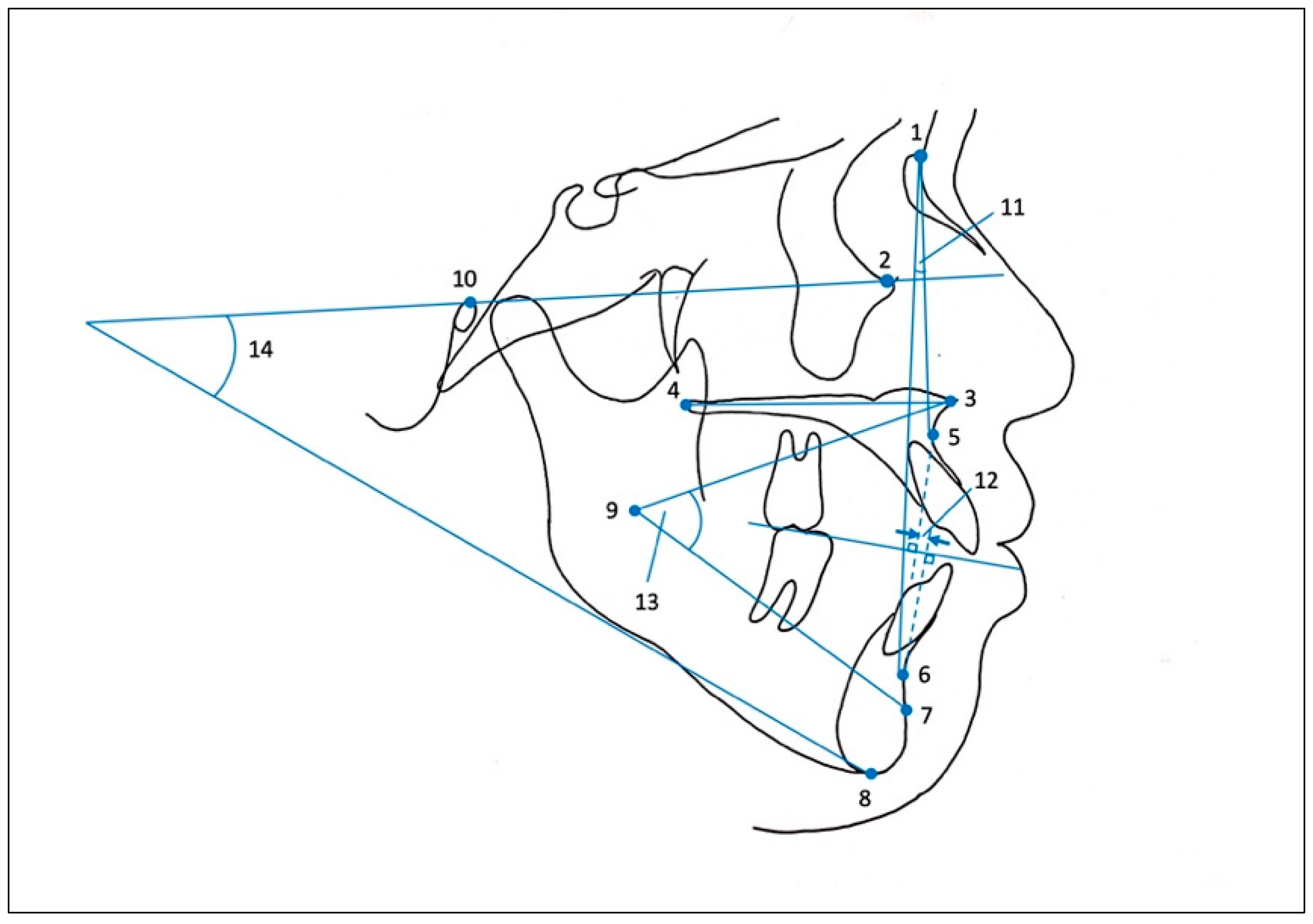 Applsci 11 08736 g004 550