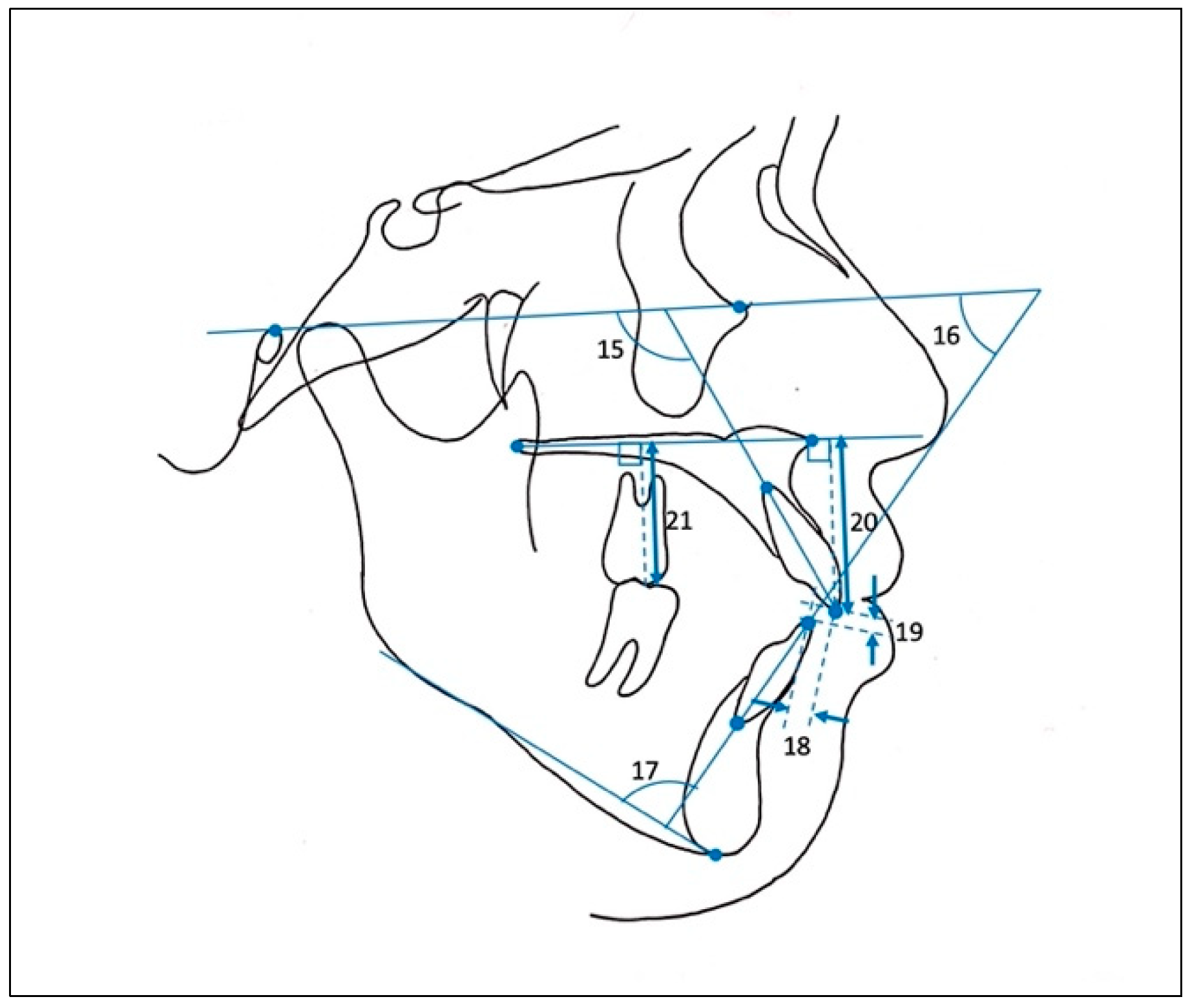 Applsci 11 08736 g005 550