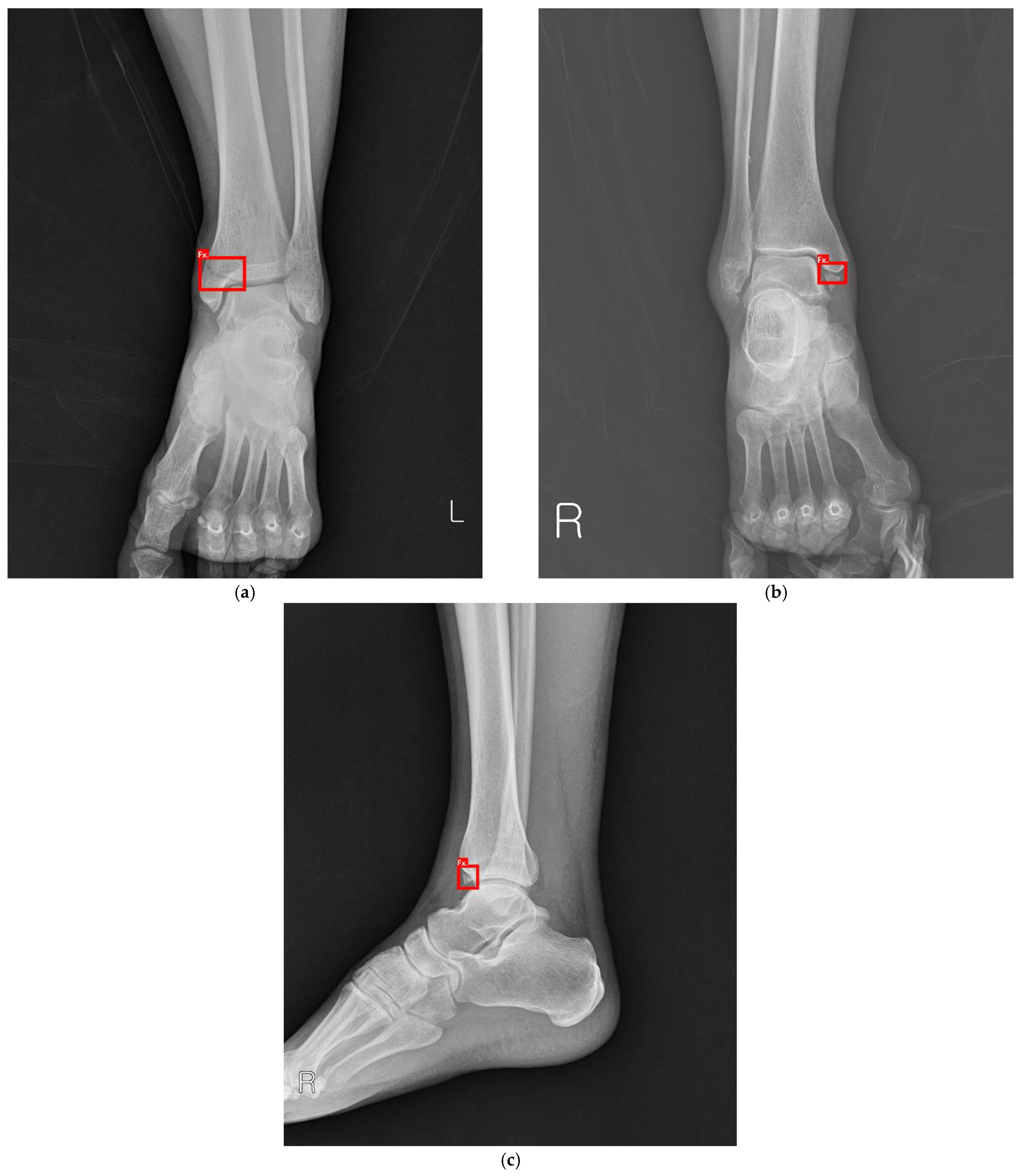 l'errore di pre-elaborazione di splint non può continuare
