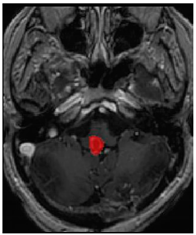 Applsci 11 09180 i012