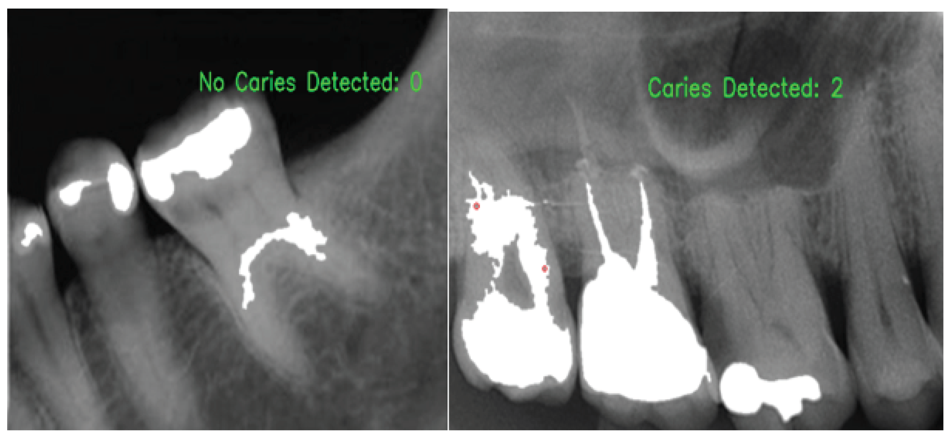 Applsci 11 09232 g005