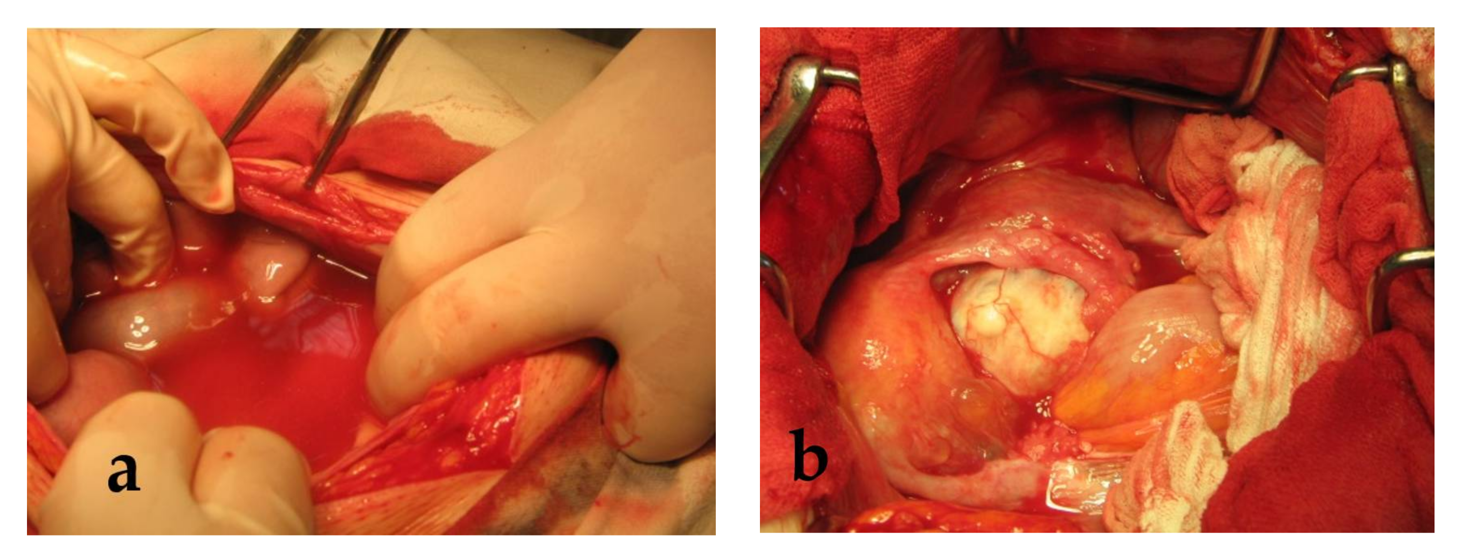 Applied Sciences | Free Full-Text | Struma Ovarii: Clinico-Morphological Features and Therapeutic Experience of a Romanian Institution over 20 Years Applied Sciences | Free Full-Text | Struma Ovarii: Clinico-Morphological Features and Therapeutic Experience of a Romanian Institution over 20 Years