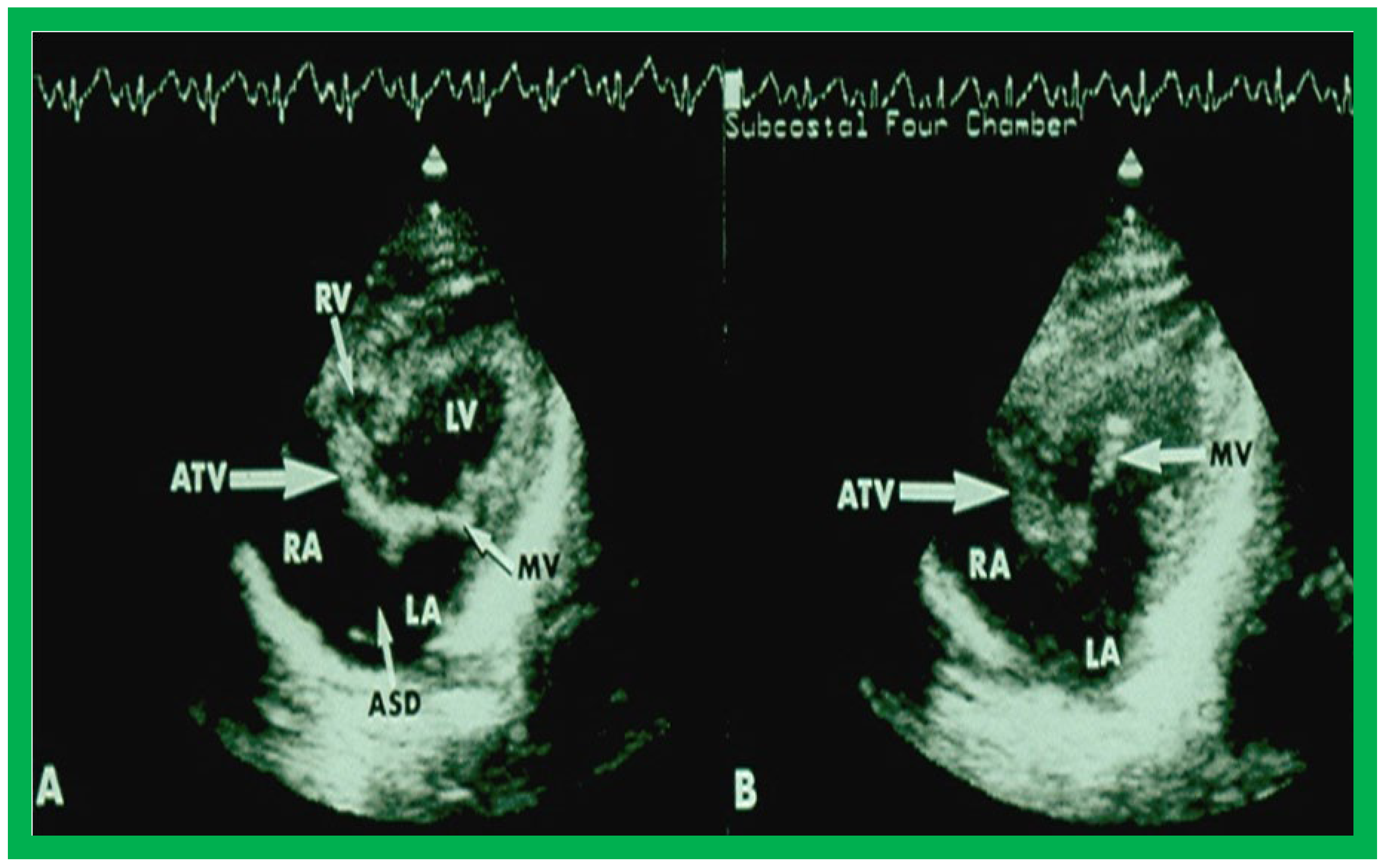 Applsci 11 09472 g004
