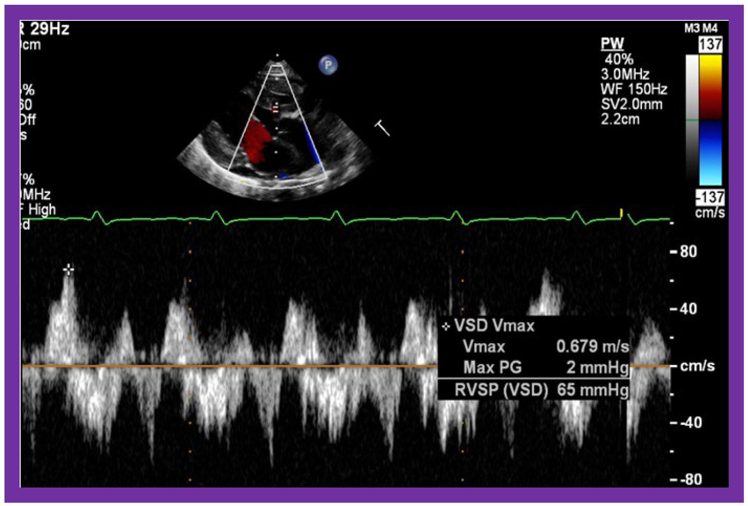 Applsci 11 09472 g015