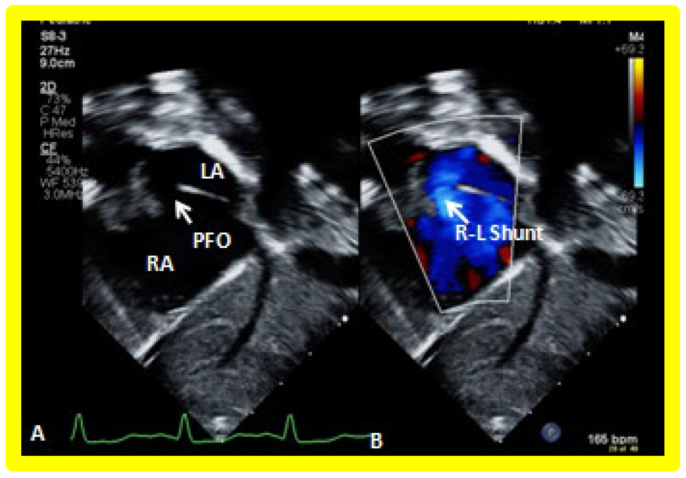 Applsci 11 09472 g018