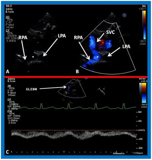 Applied Sciences | Free Full-Text | Echocardiography in the Diagnosis ...