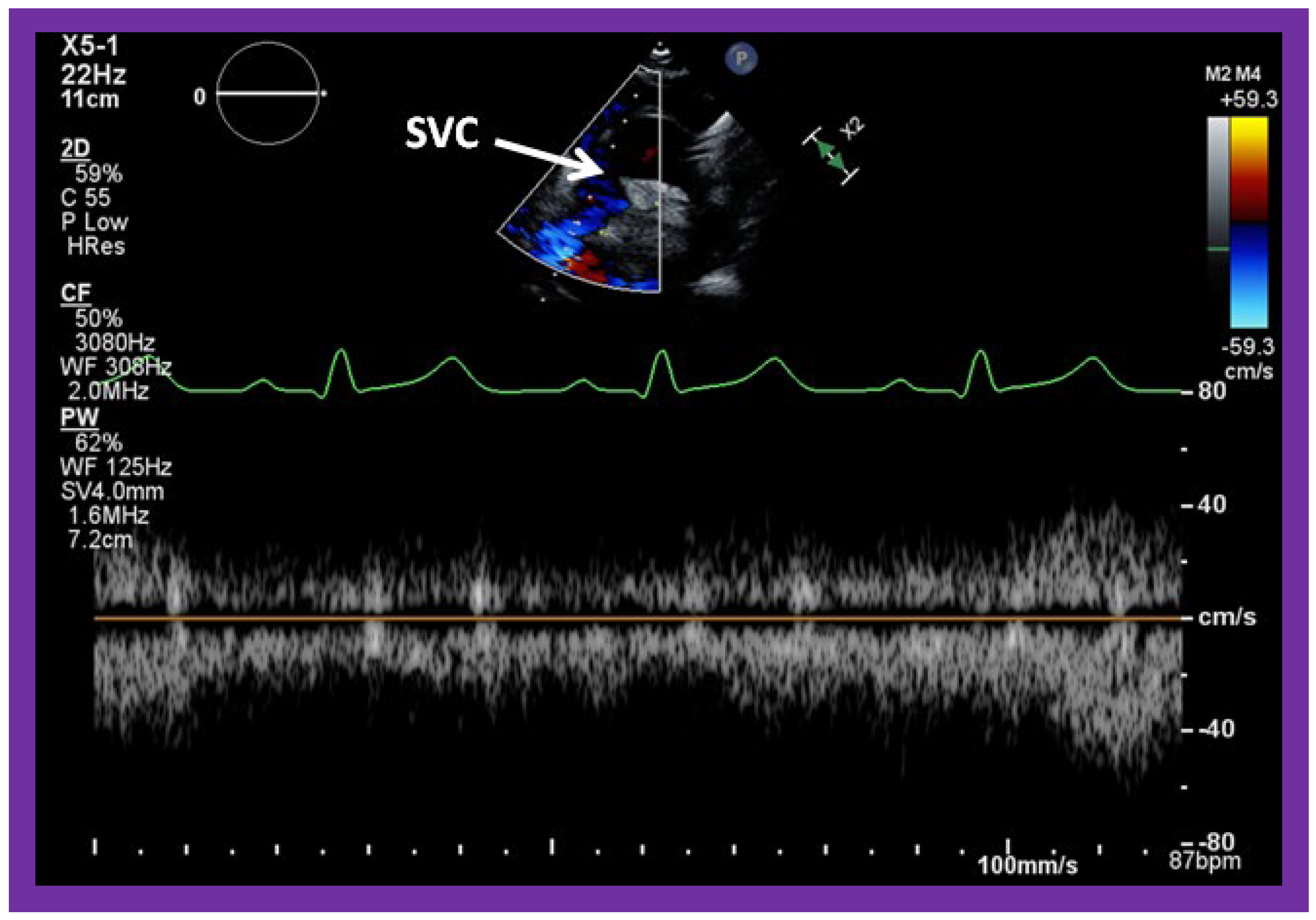 Applsci 11 09472 g055