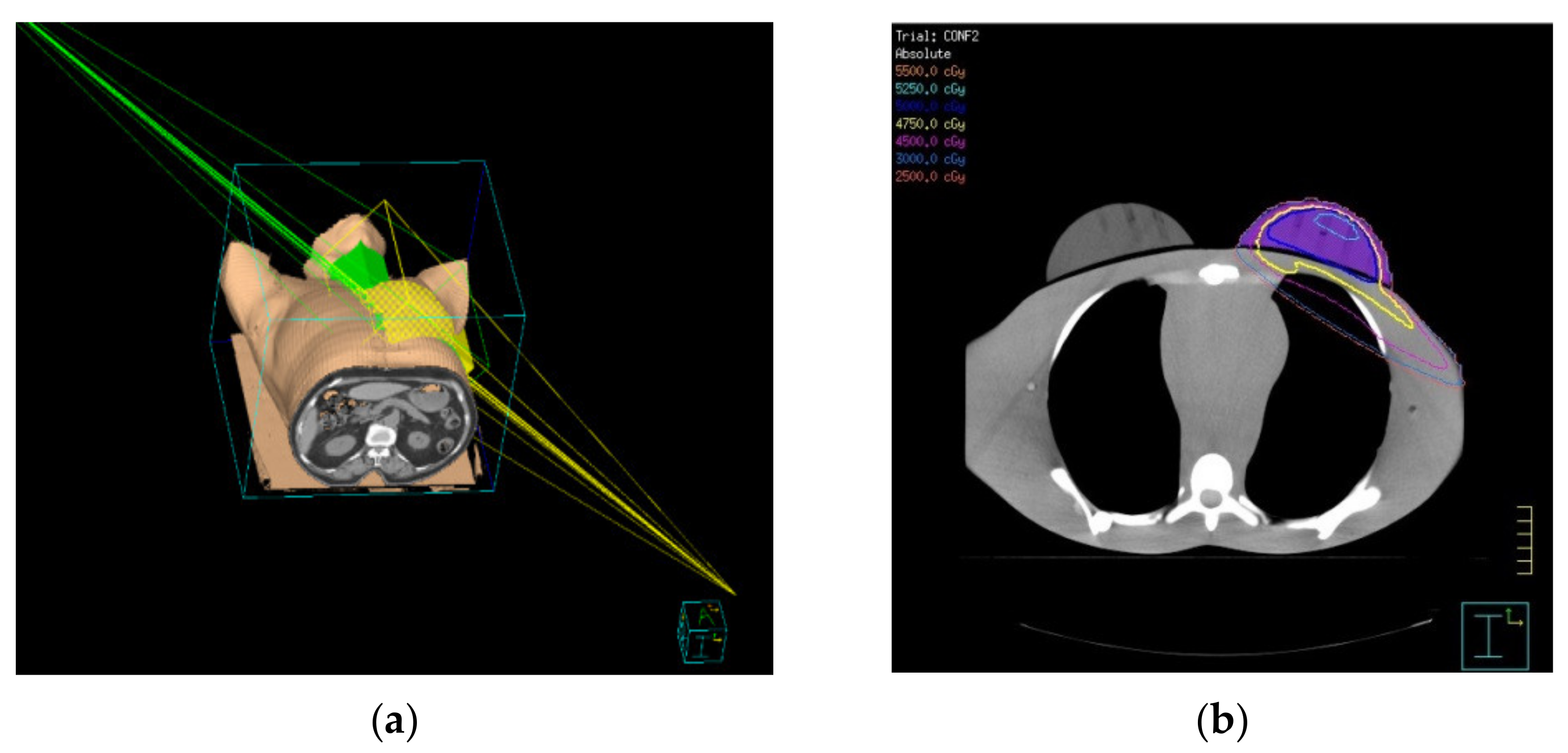 Breast volumes of human subjects in three scanning positions