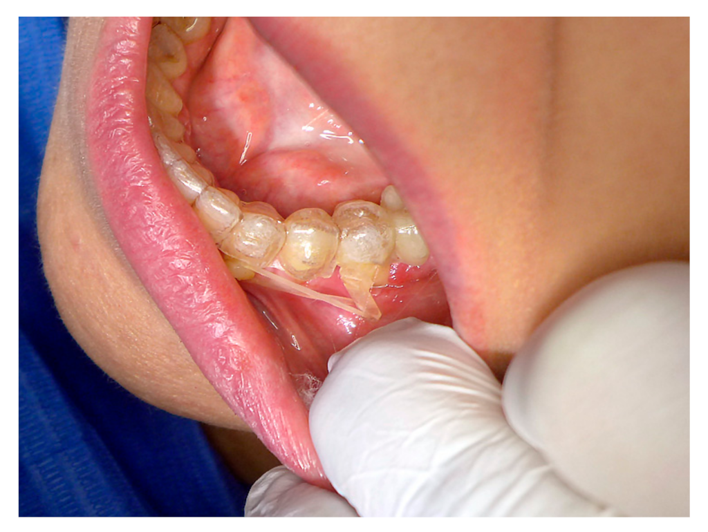 Applsci 11 09693 g008 550