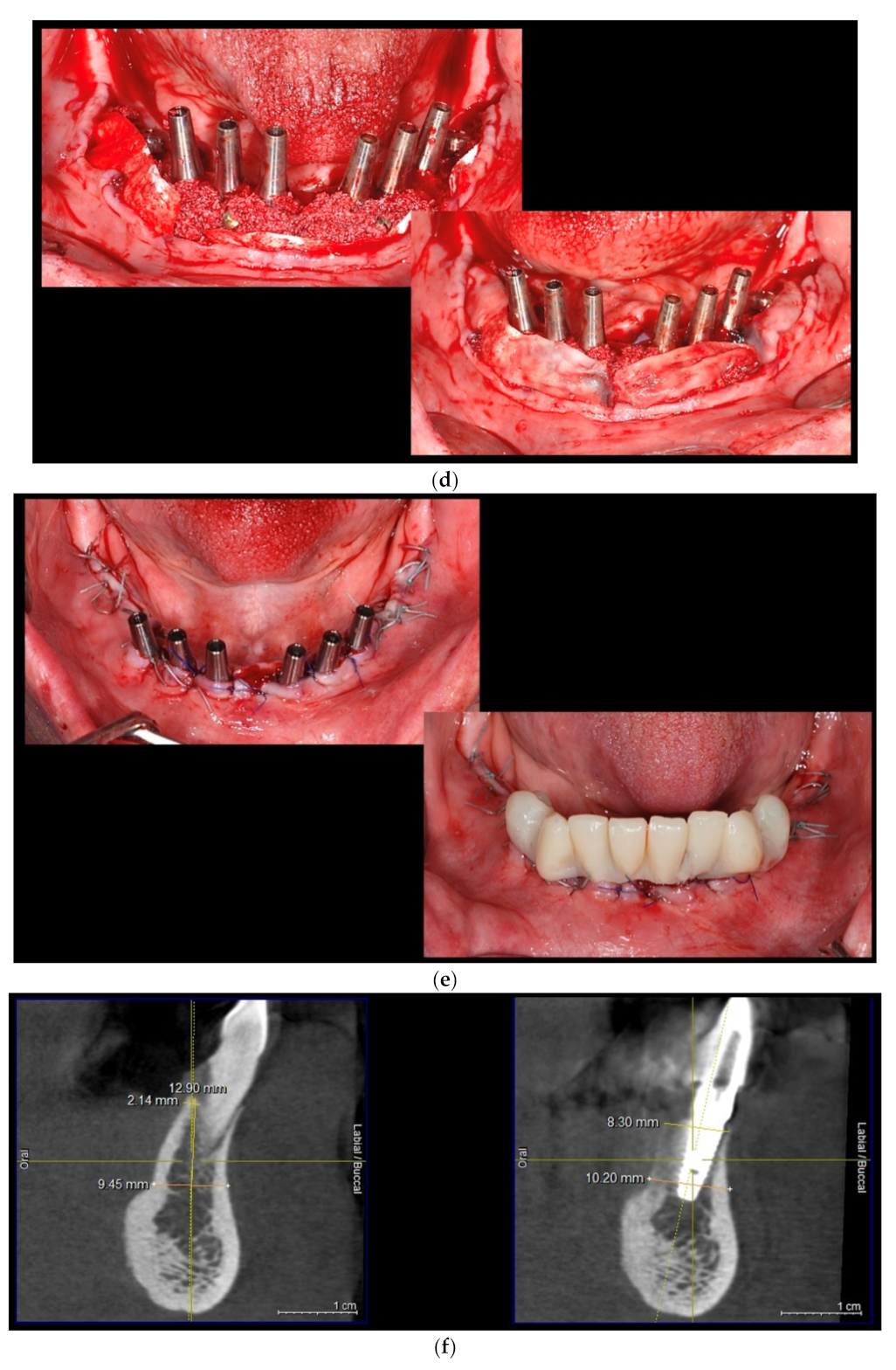 Applsci 11 09826 g001b 550
