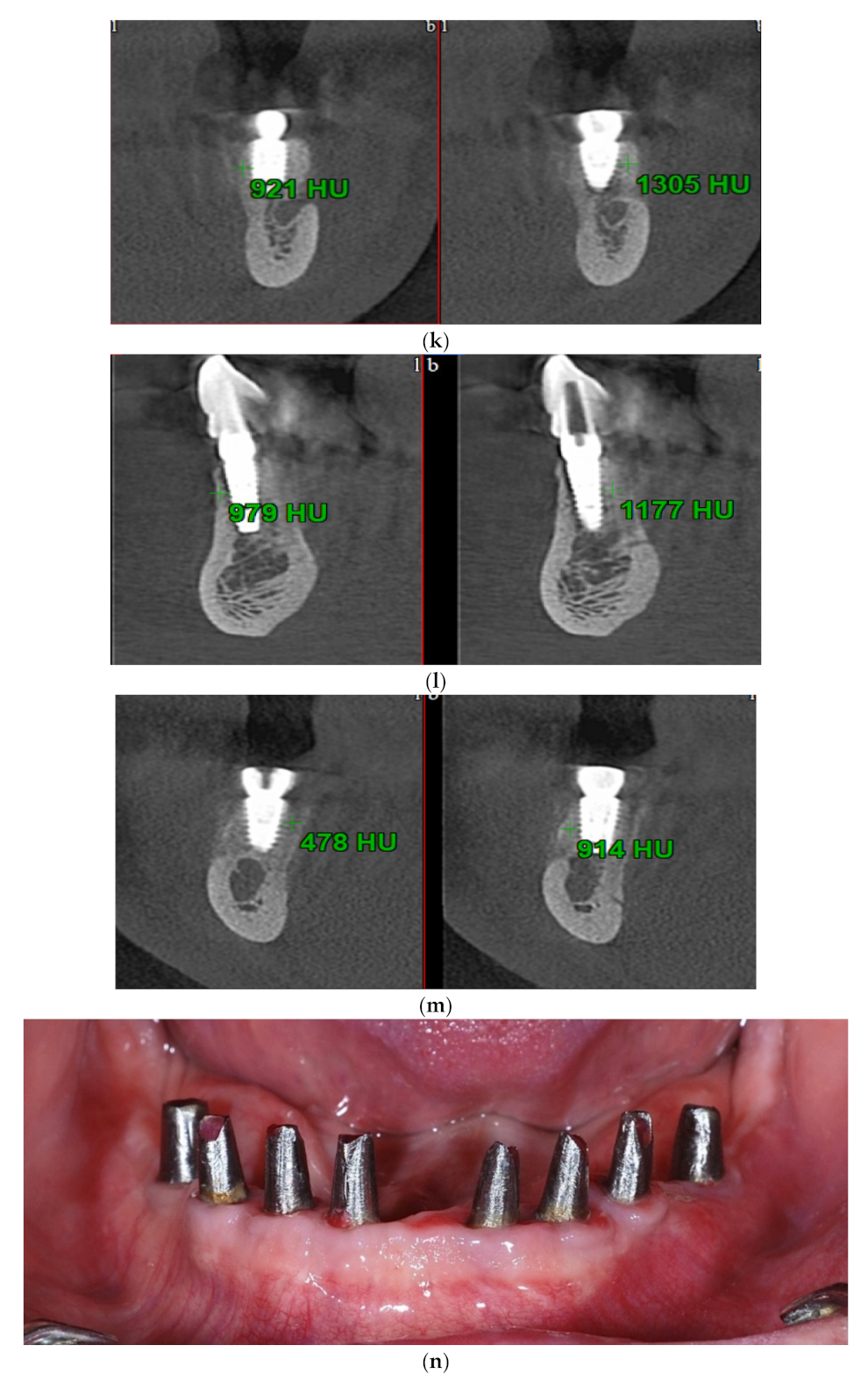 Applsci 11 09826 g001d 550