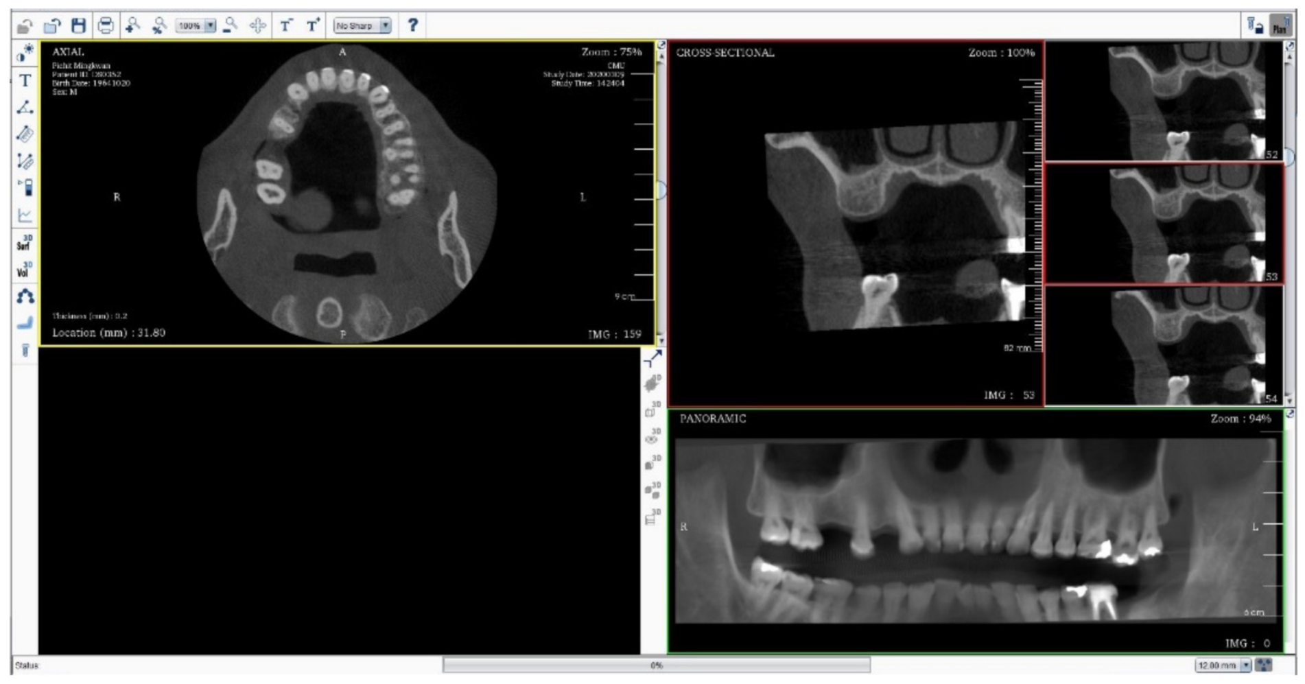 The Learning Curve of Artificial Intelligence for Dental