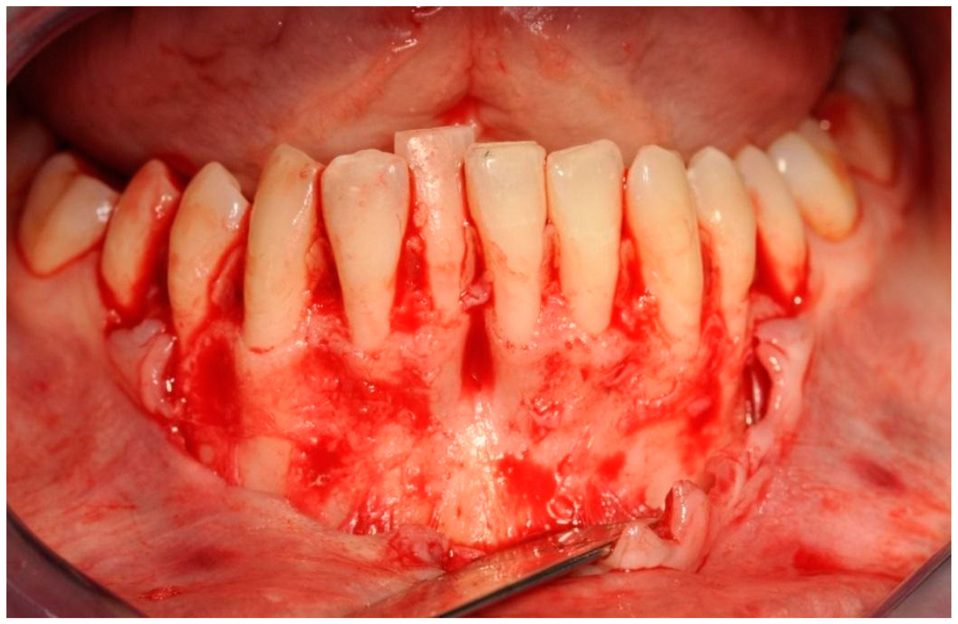 Applsci 11 10299 g005 550