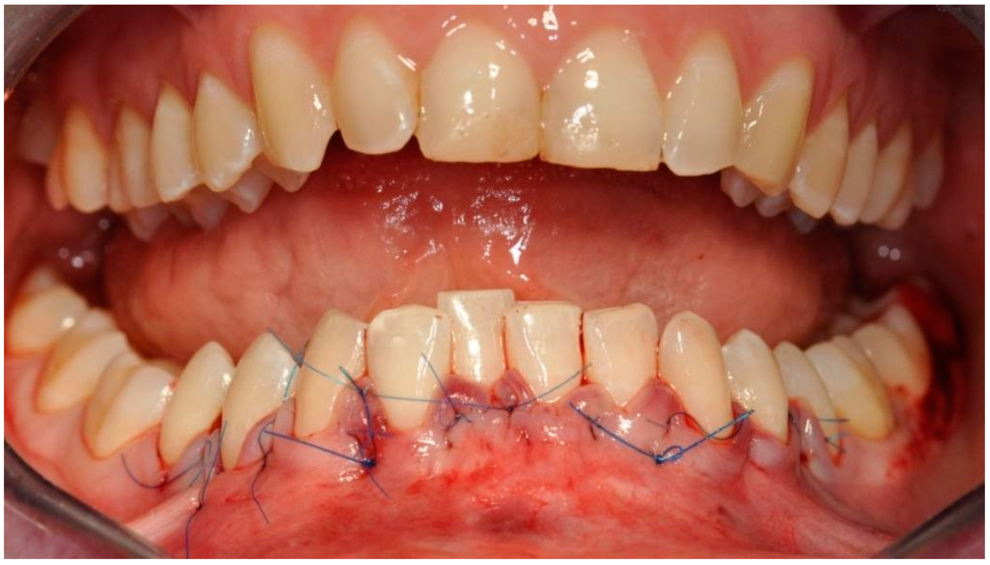 Applsci 11 10299 g009 550