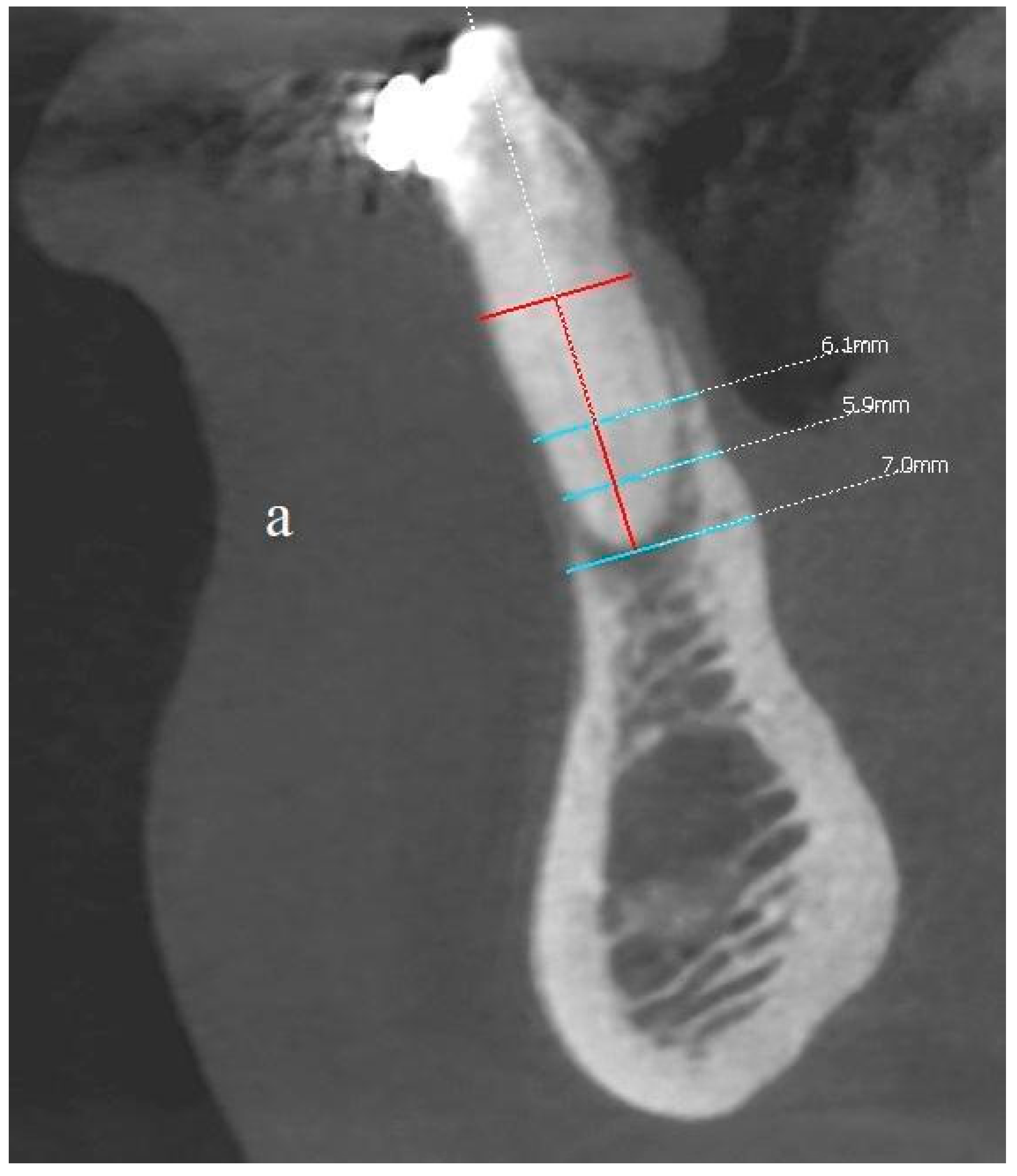 Applsci 11 10299 g013a 550