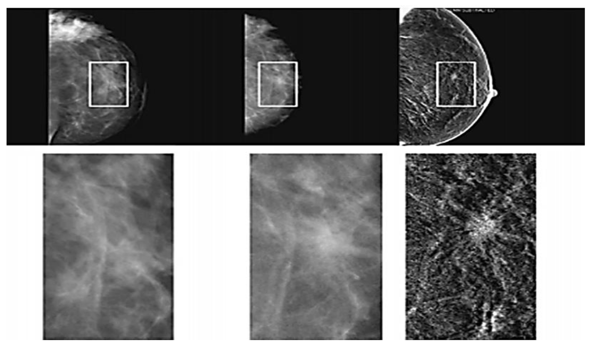Existing and Emerging Breast Cancer Detection Technologies and Its ...