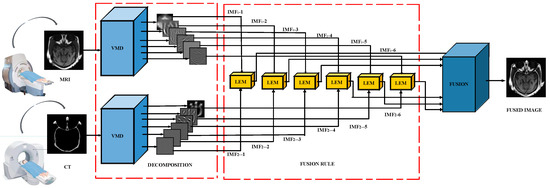 The Fusion of MRI and CT Medical Images Using Variational Mode ...