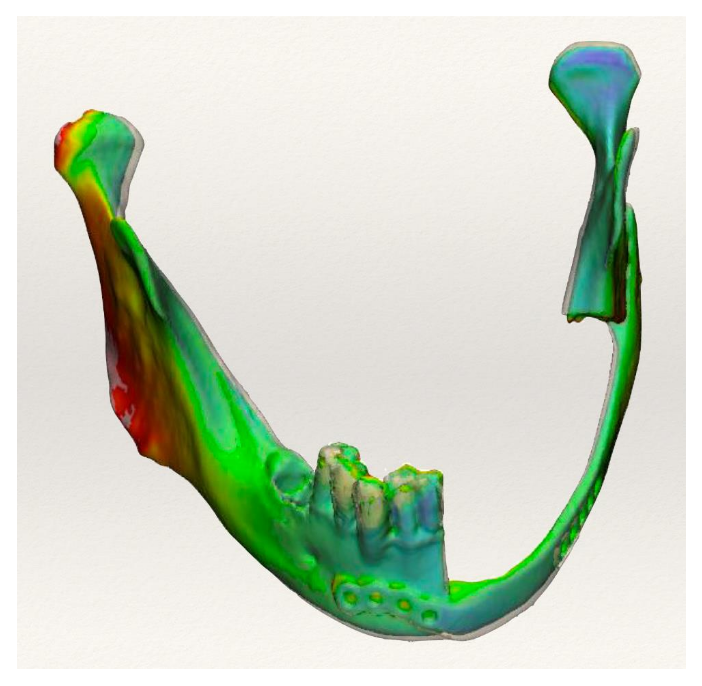 Applsci 11 11069 g006 550