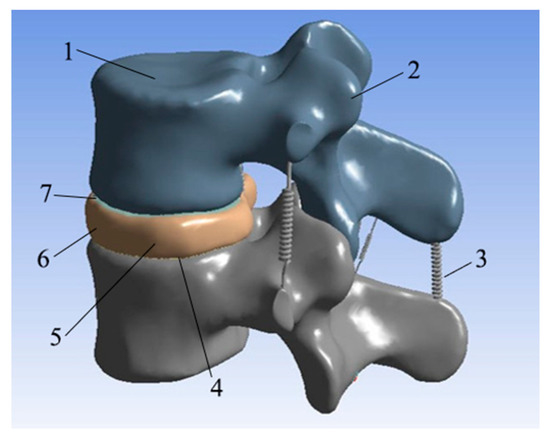 Design and 3D Printing of Interbody Fusion Cage Based on TPMS Porous ...