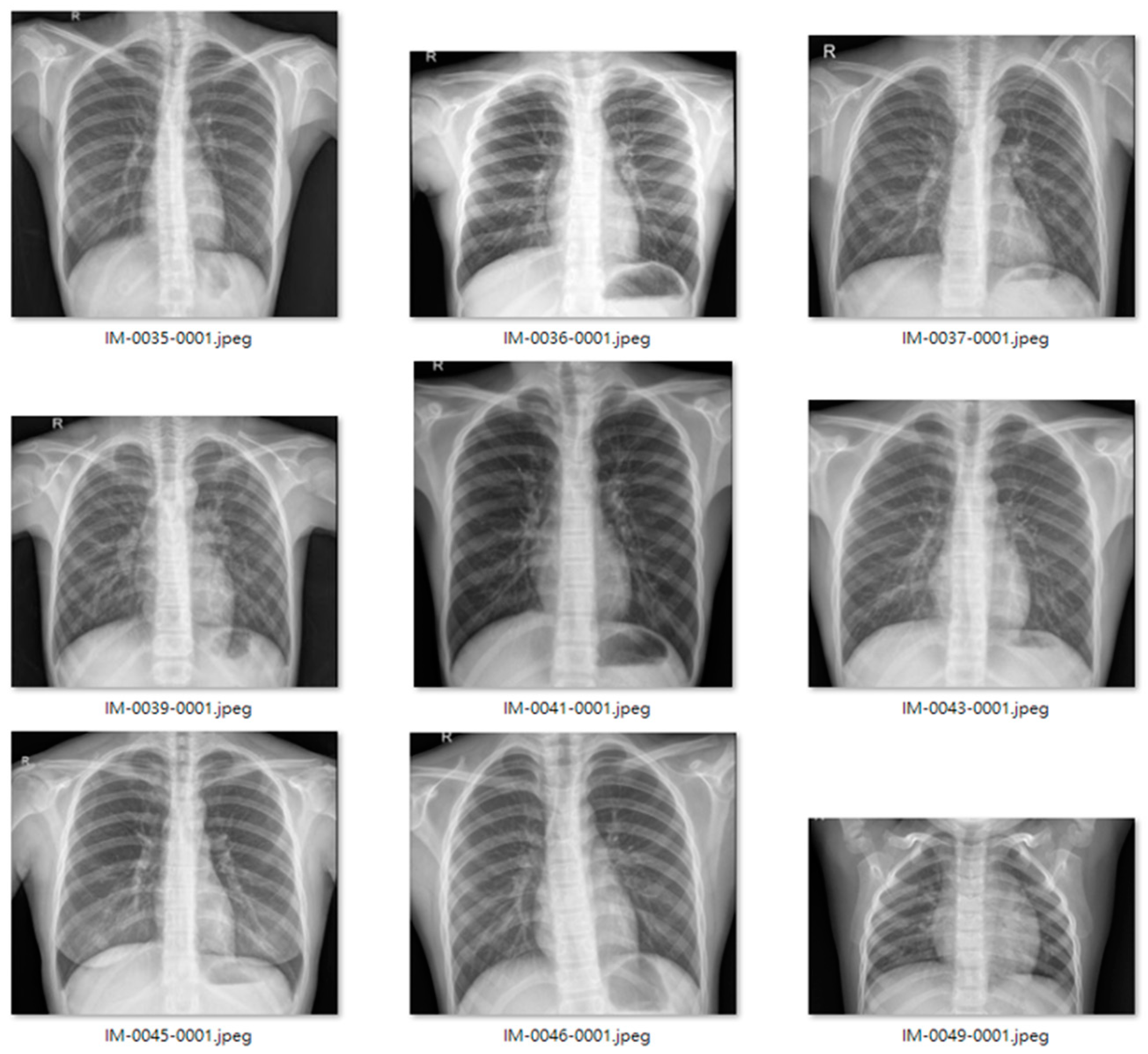 Applsci 11 11185 g011 550