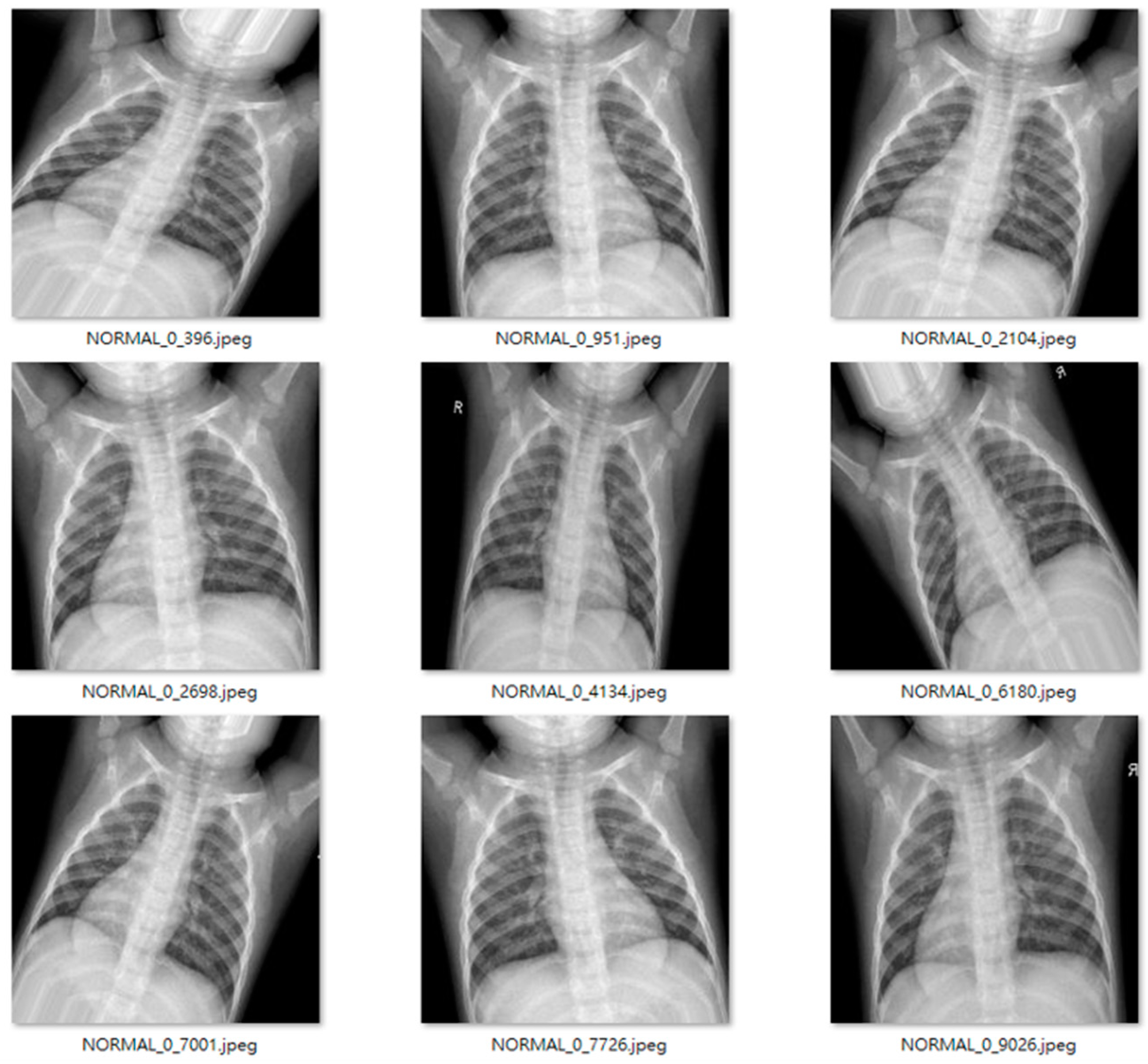 Applsci 11 11185 g012 550