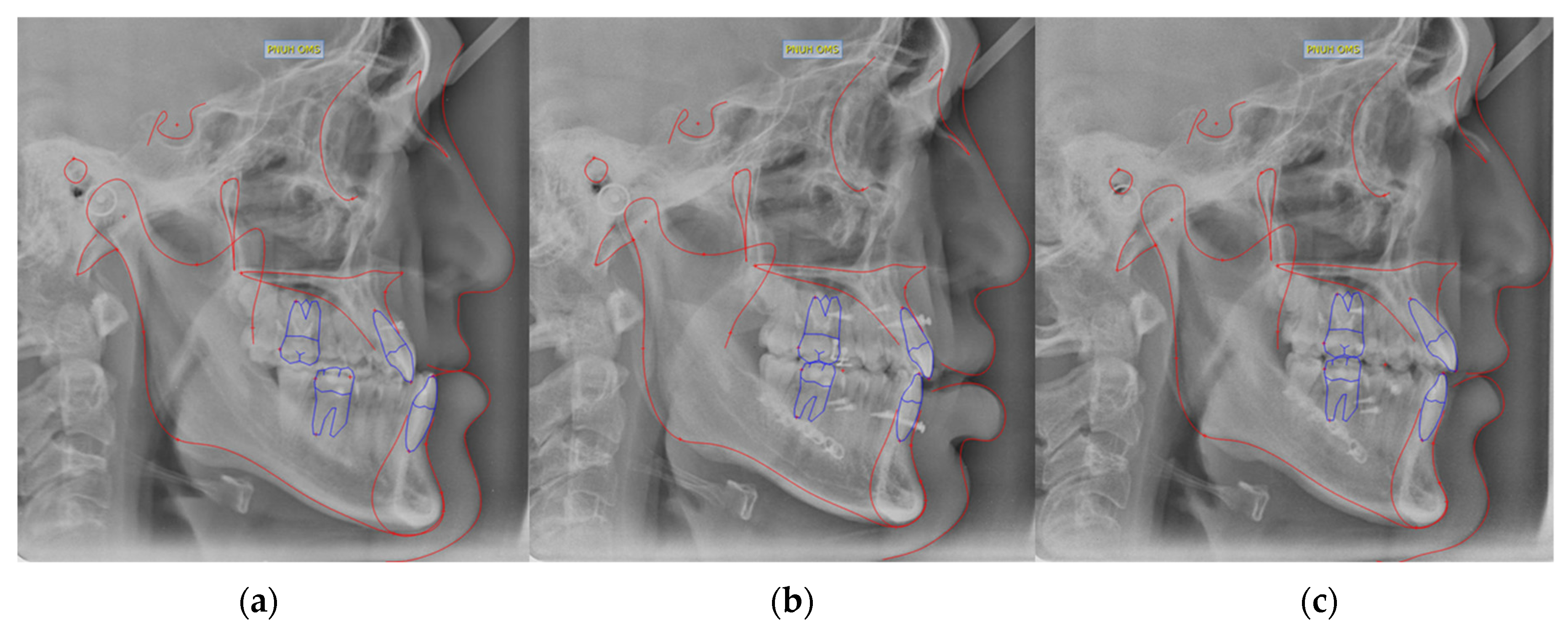 Applsci 11 11216 g001 550