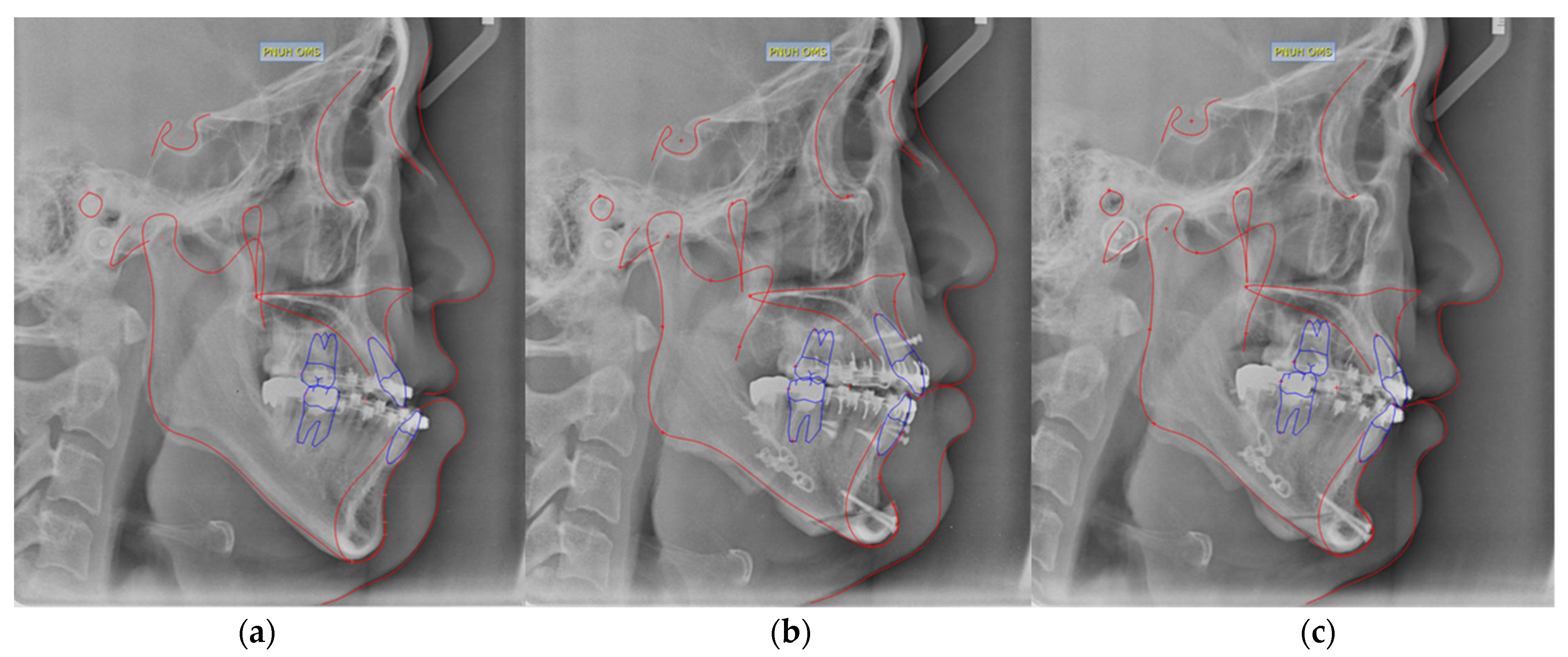 Applsci 11 11216 g002 550