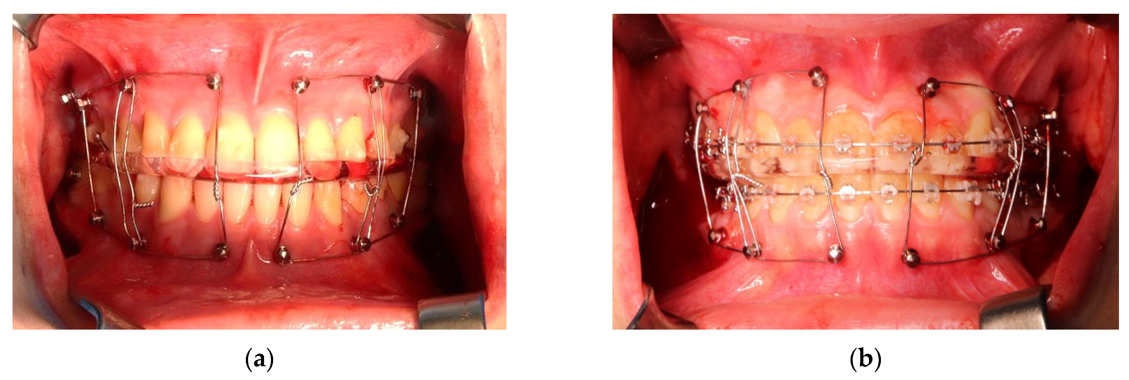 Applsci 11 11216 g010 550