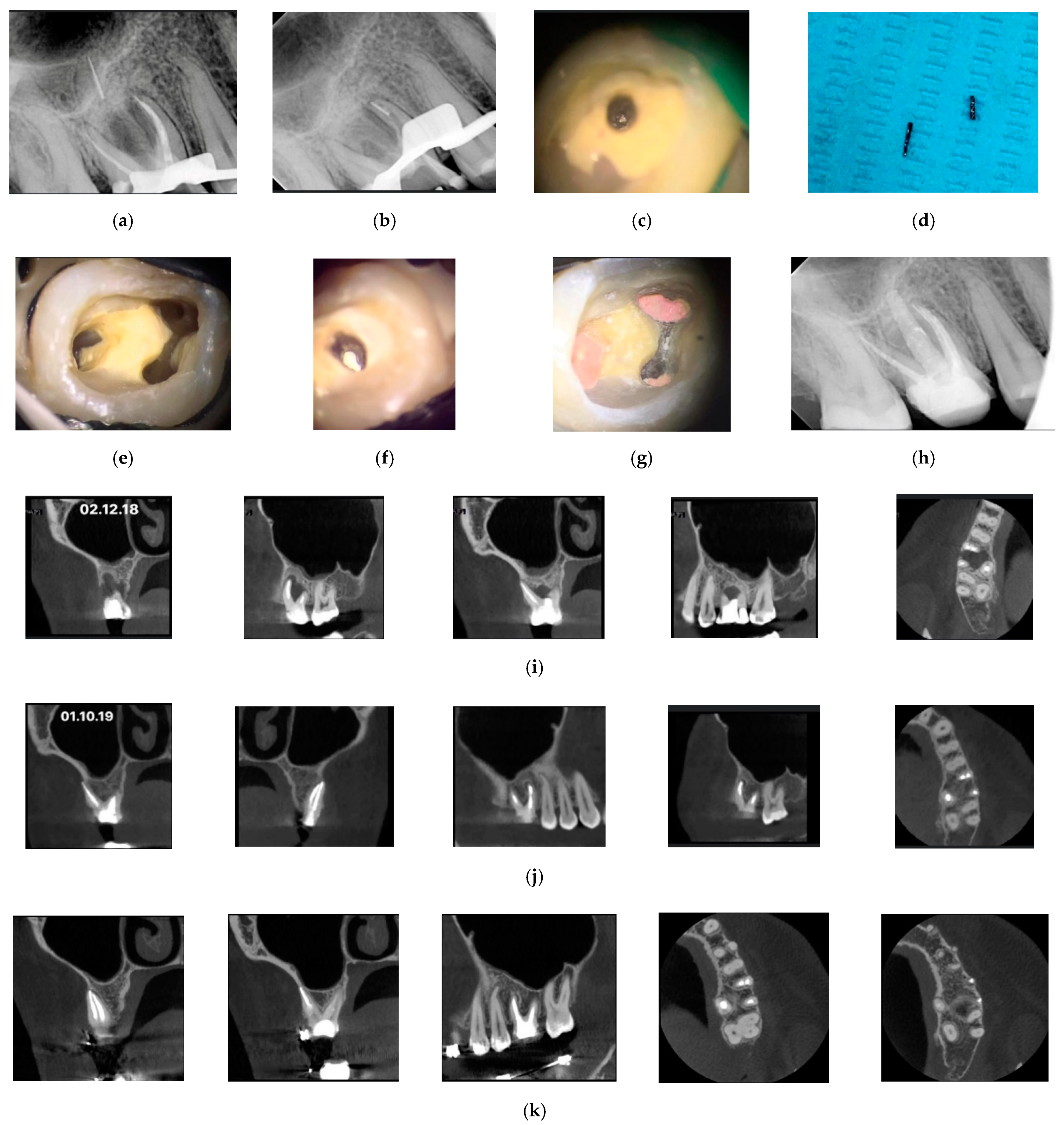 Applsci 11 11293 g002 Applsci 11 11293 g002