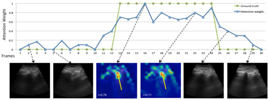 Applied Sciences | Free Full-Text | B-Line Detection and Localization ...