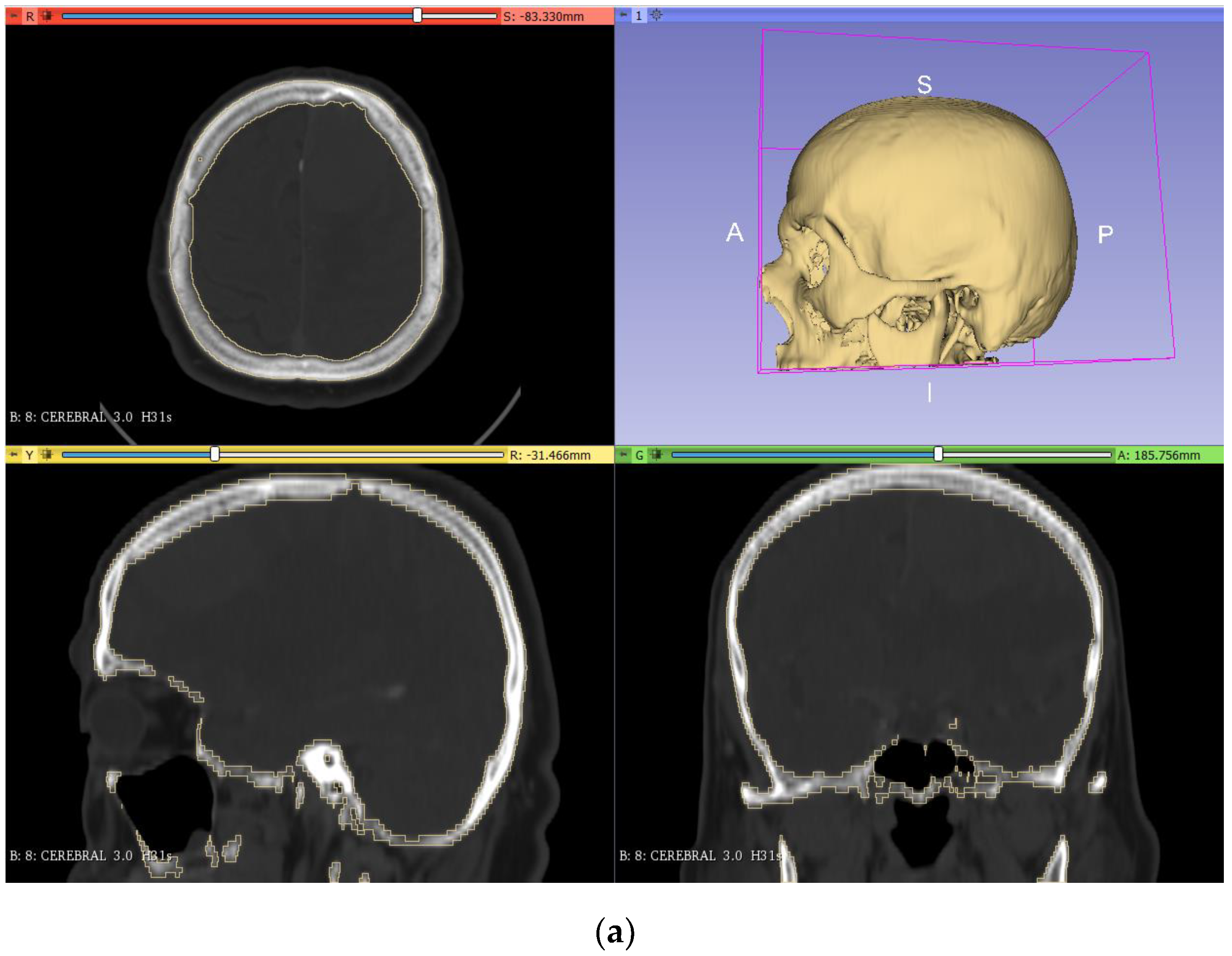 Applsci 11 11823 g002a 550