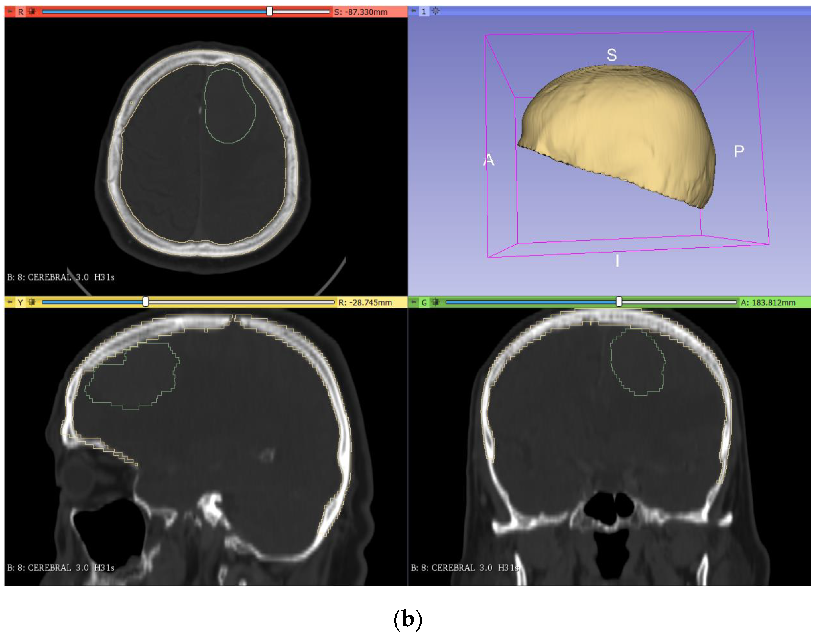 Applsci 11 11823 g002b 550