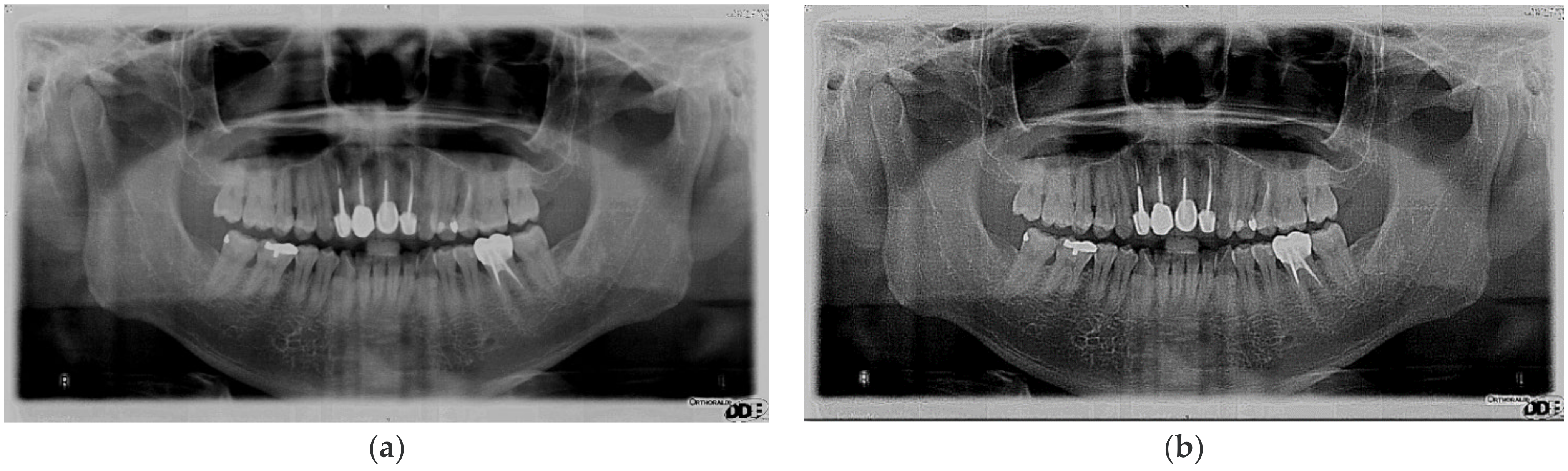 Applsci 11 11904 g003