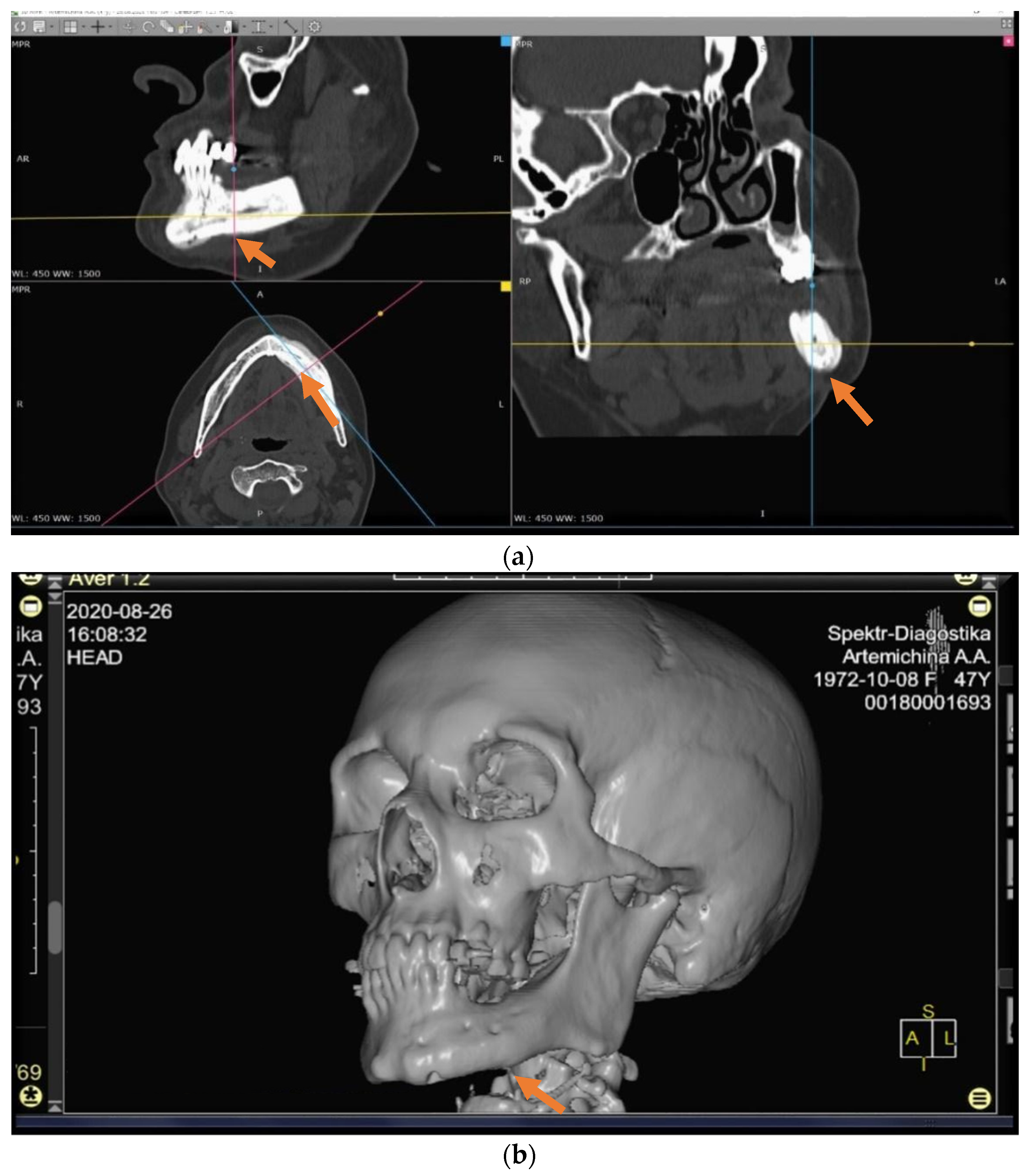 Applsci 11 11950 g003 550