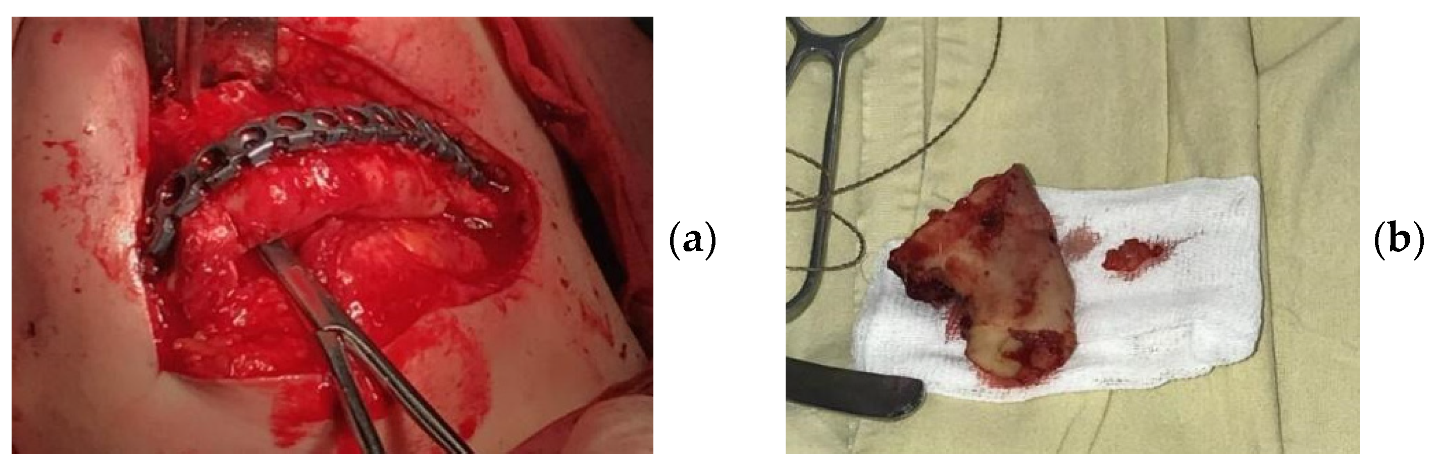 Applsci 11 11950 g005 550