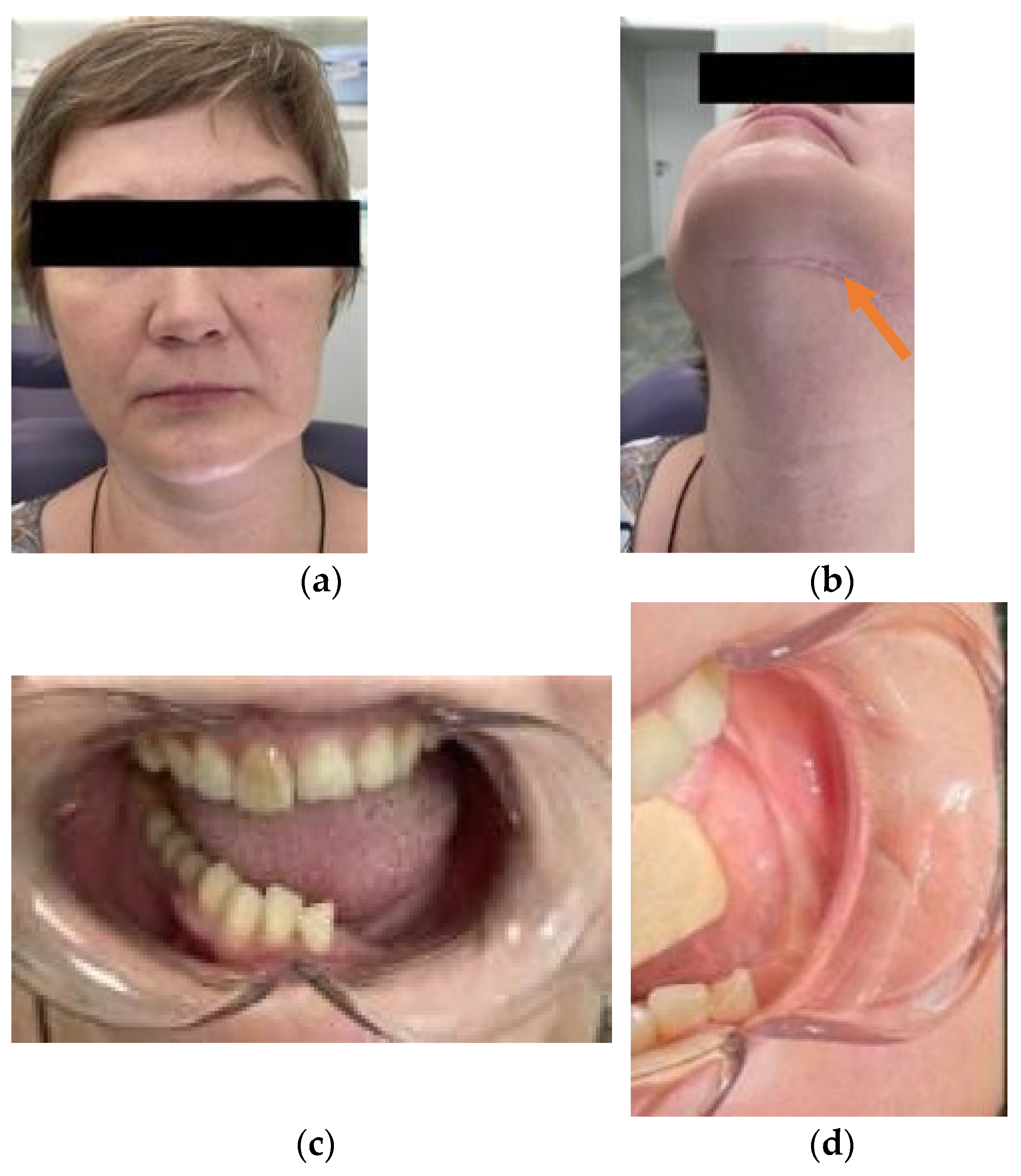 Applsci 11 11950 g007 550