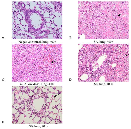Comparison of Genotoxicity and Pulmonary Toxicity Study of Modified ...