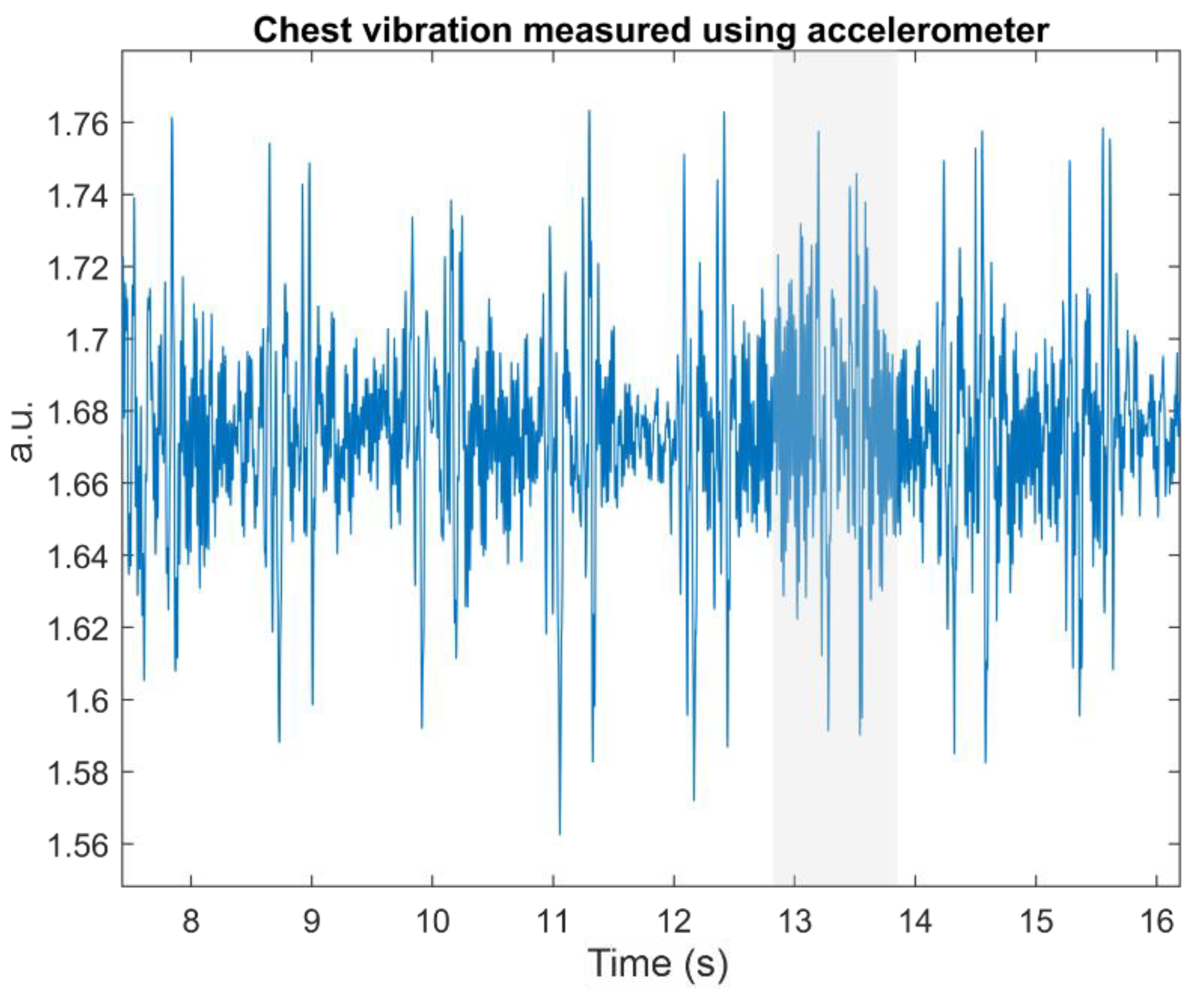 Discrete Wavelet Transforms-Based Analysis of Accelerometer Signals for ...