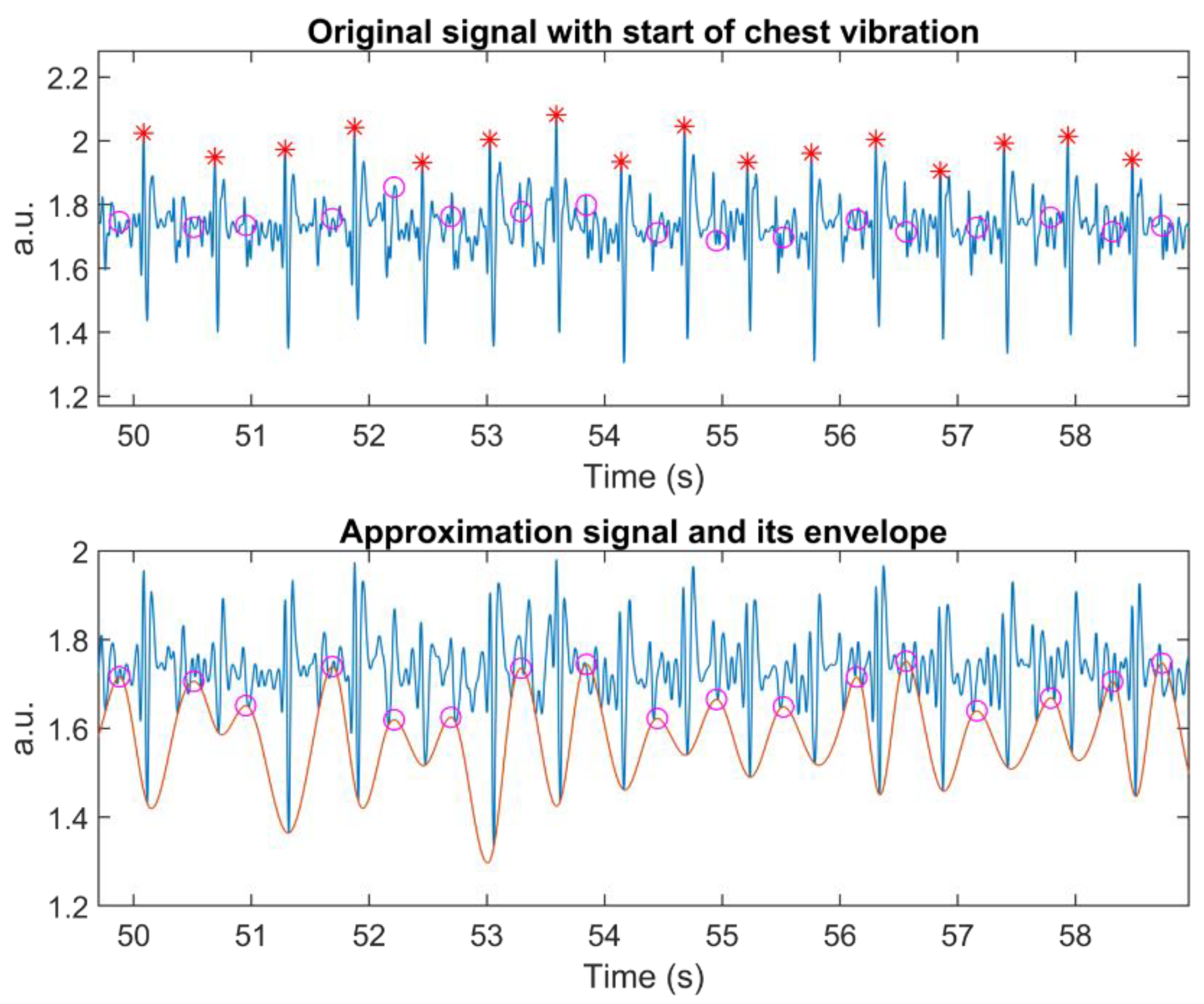Discrete Wavelet Transforms-Based Analysis of Accelerometer Signals for ...