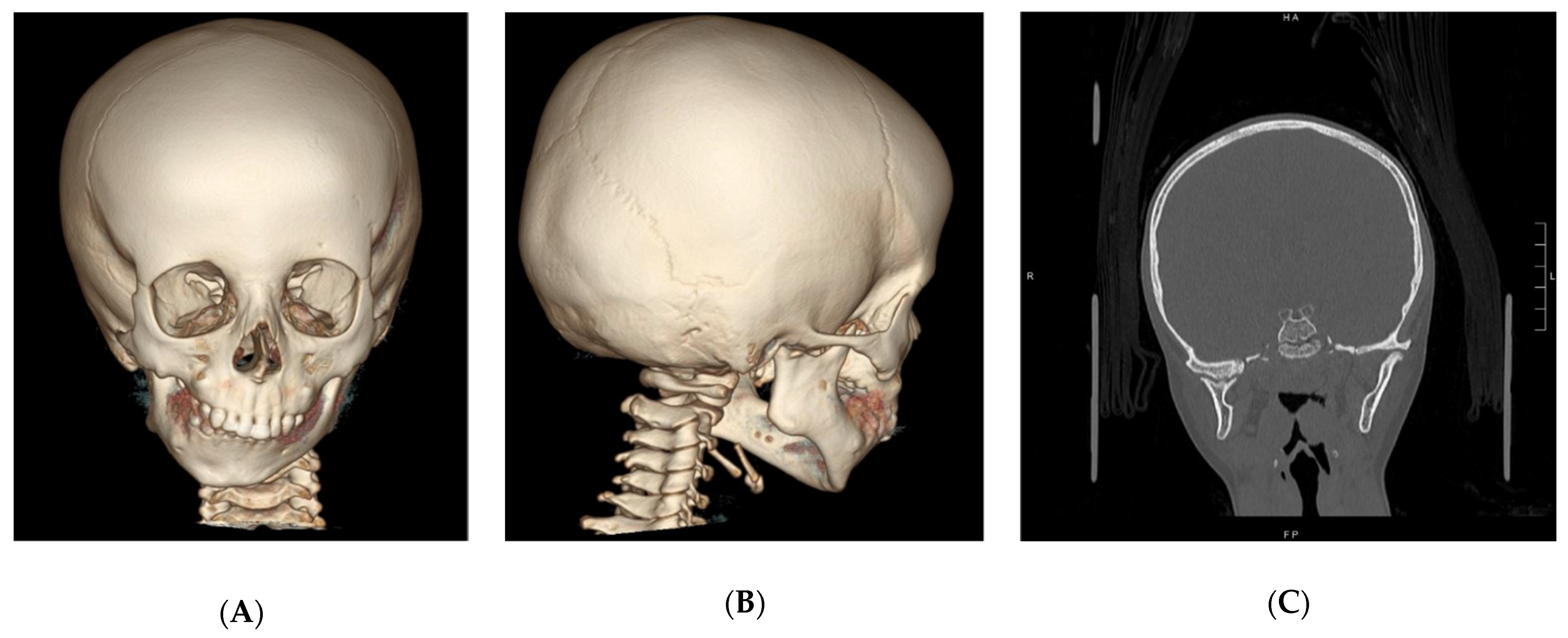 Applsci 12 00142 g002