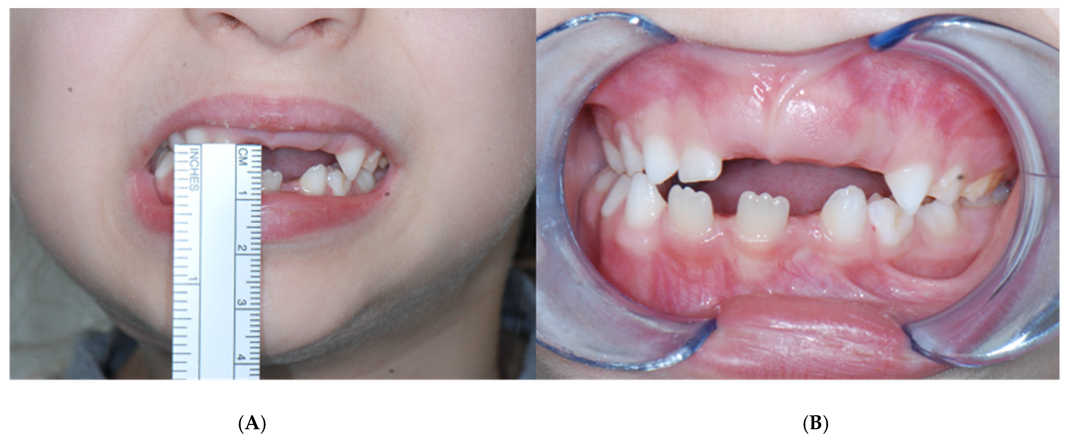 Applsci 12 00142 g004