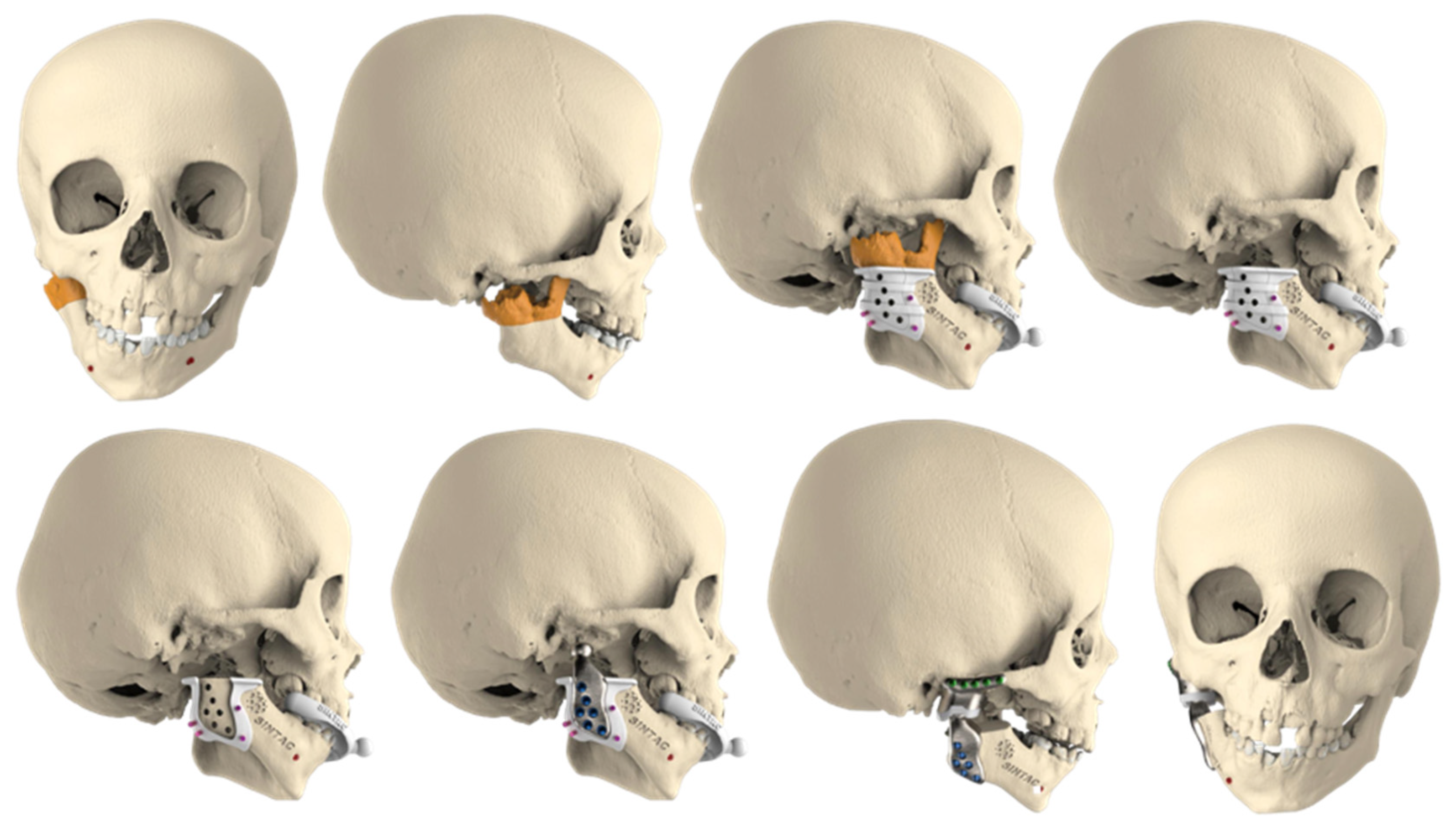 Applsci 12 00142 g005