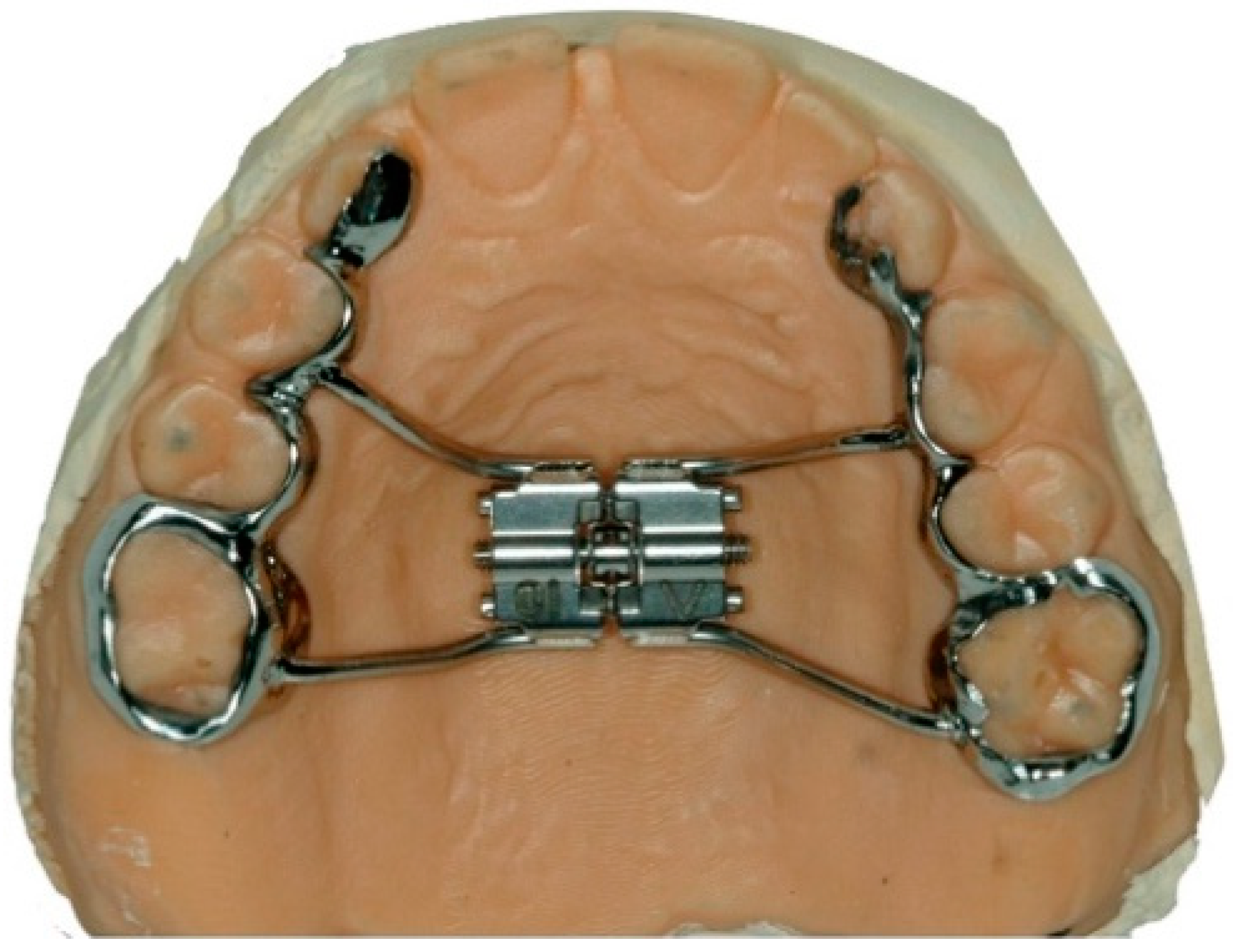 Properties of CAD/CAM 3D Printing Dental Materials and Their Clinical ...