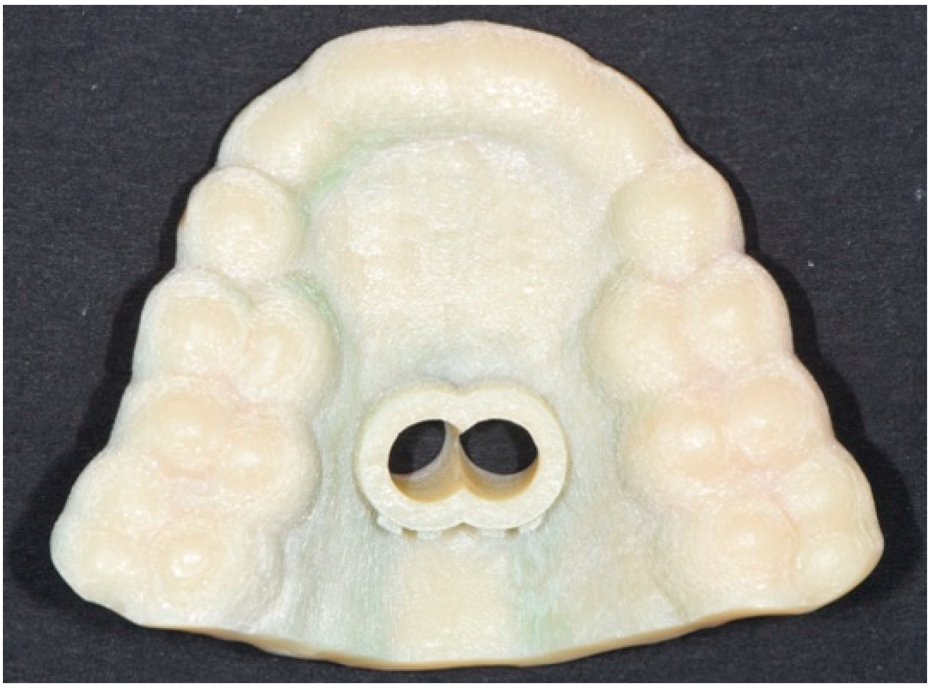 Properties of CAD/CAM 3D Printing Dental Materials and Their Clinical ...
