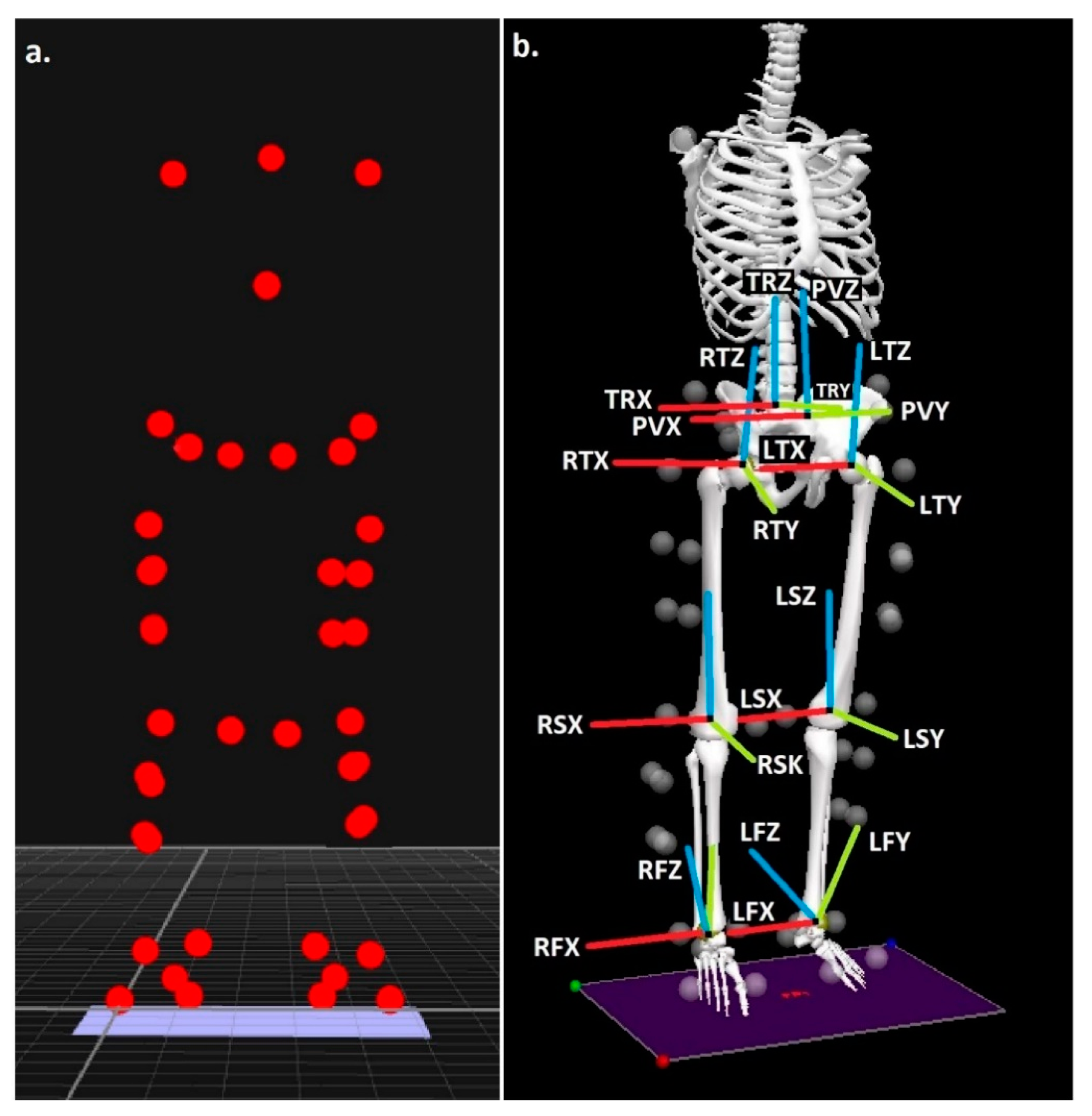 MOTION PALPATION OF THE EXTREMITY 上・下巻 The Muscle and Bone Palpation Manual with Trigge: 3rd