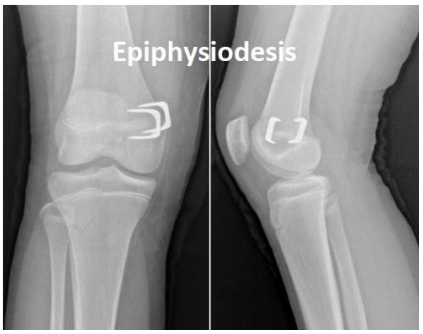 Applsci 12 00614 g004 550