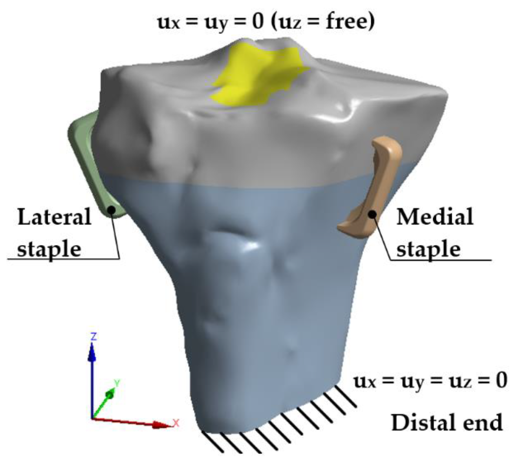 Applsci 12 00614 g011 550