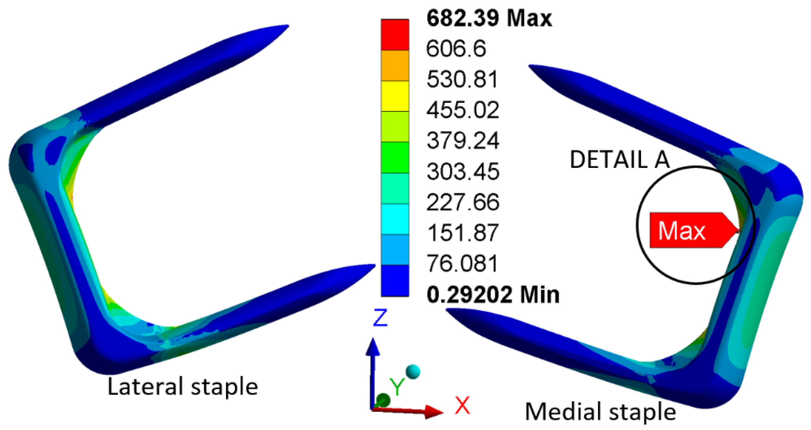 Applied Sciences | Free Full-Text | Biomechanical Analysis of ...