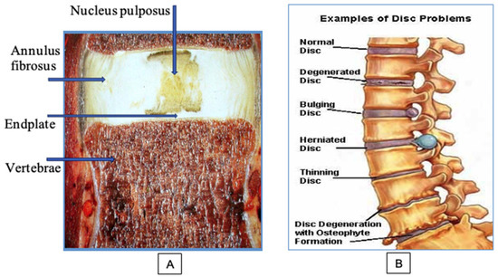 Applied Sciences | Free Full-Text | Laser Reconstruction Of Spinal Discs  Experiments And Clinic | Html