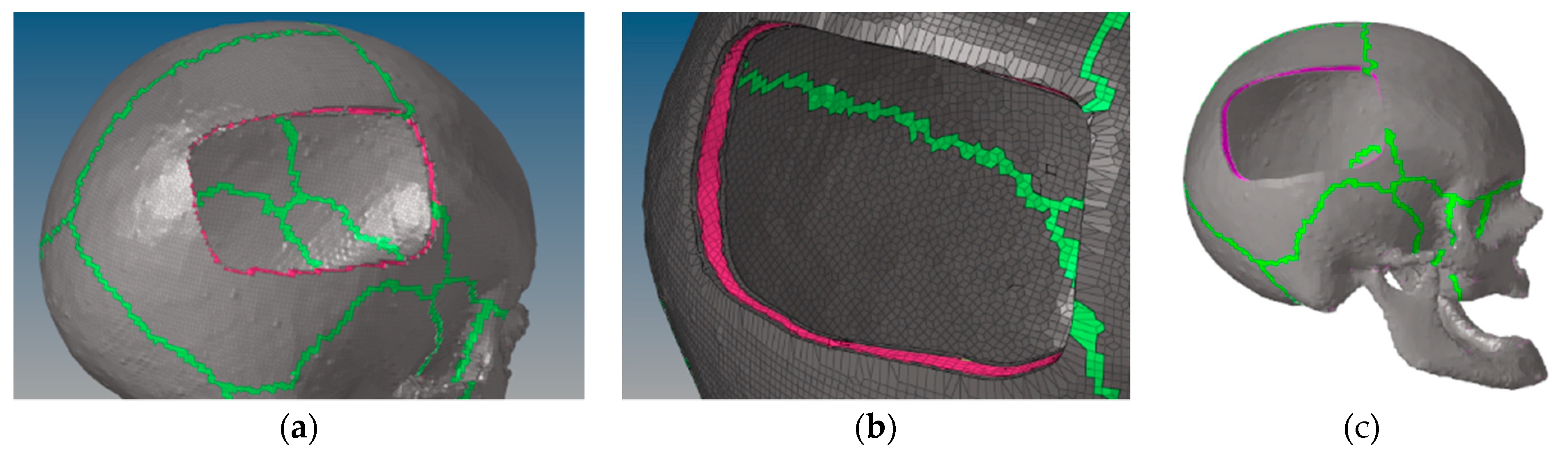 Applsci 12 00878 g001